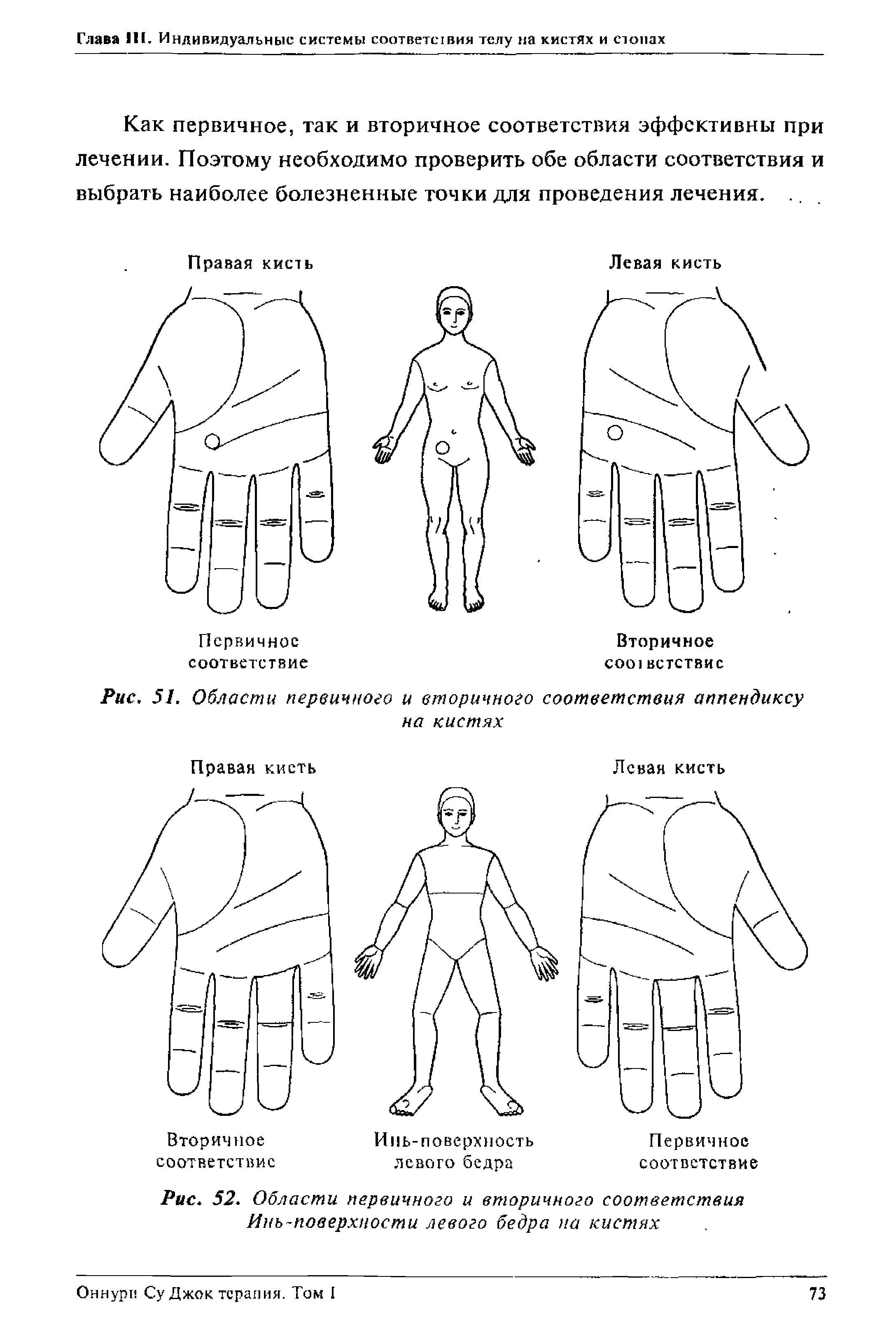 Рис. 51. Области первичного и вторичного соответствия аппендиксу на кистях...
