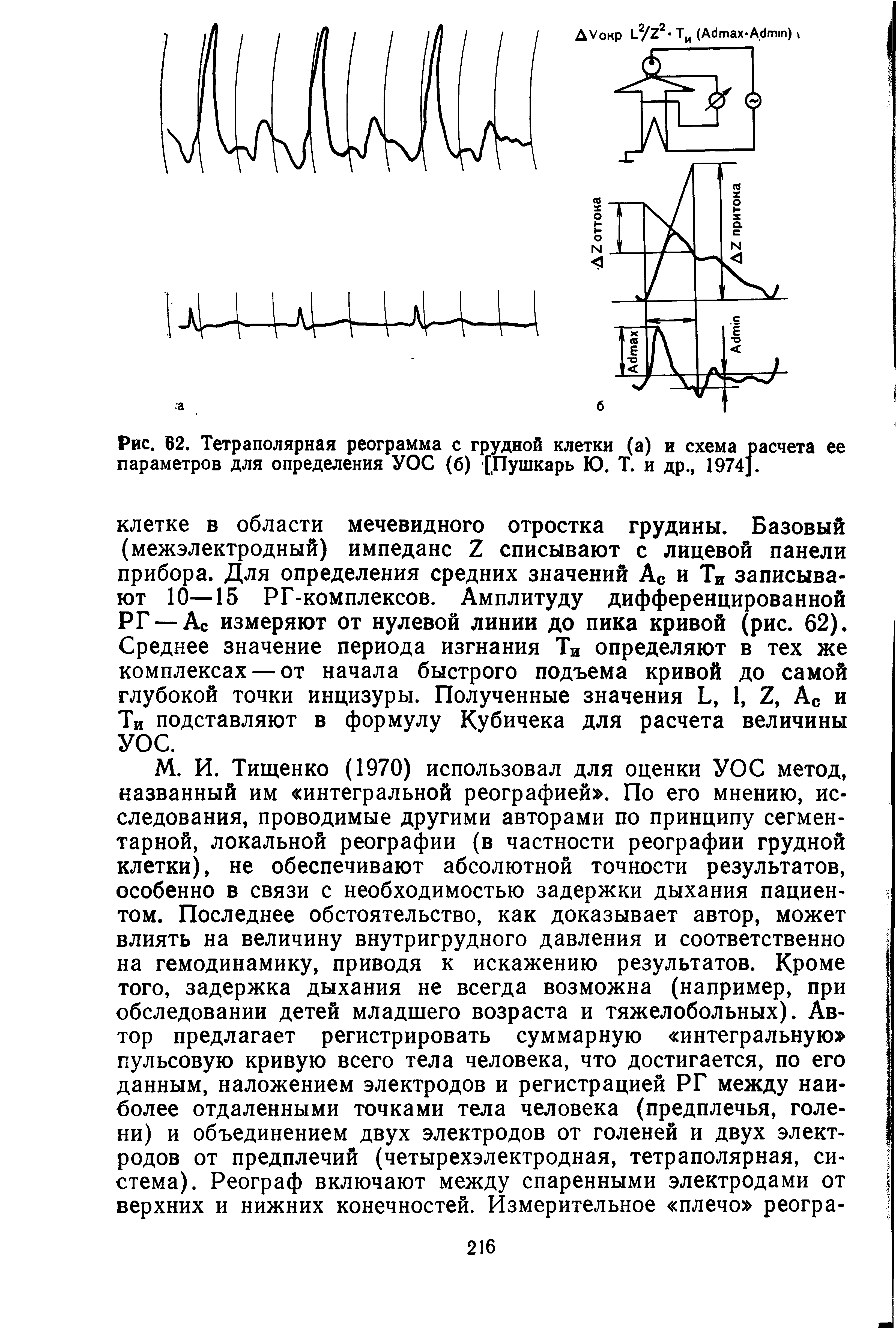 Рис. 62. Тетраполярная реограмма с грудной клетки (а) и схема расчета ее параметров для определения УОС (б) [Пушкарь Ю. Т. и др., 1974].