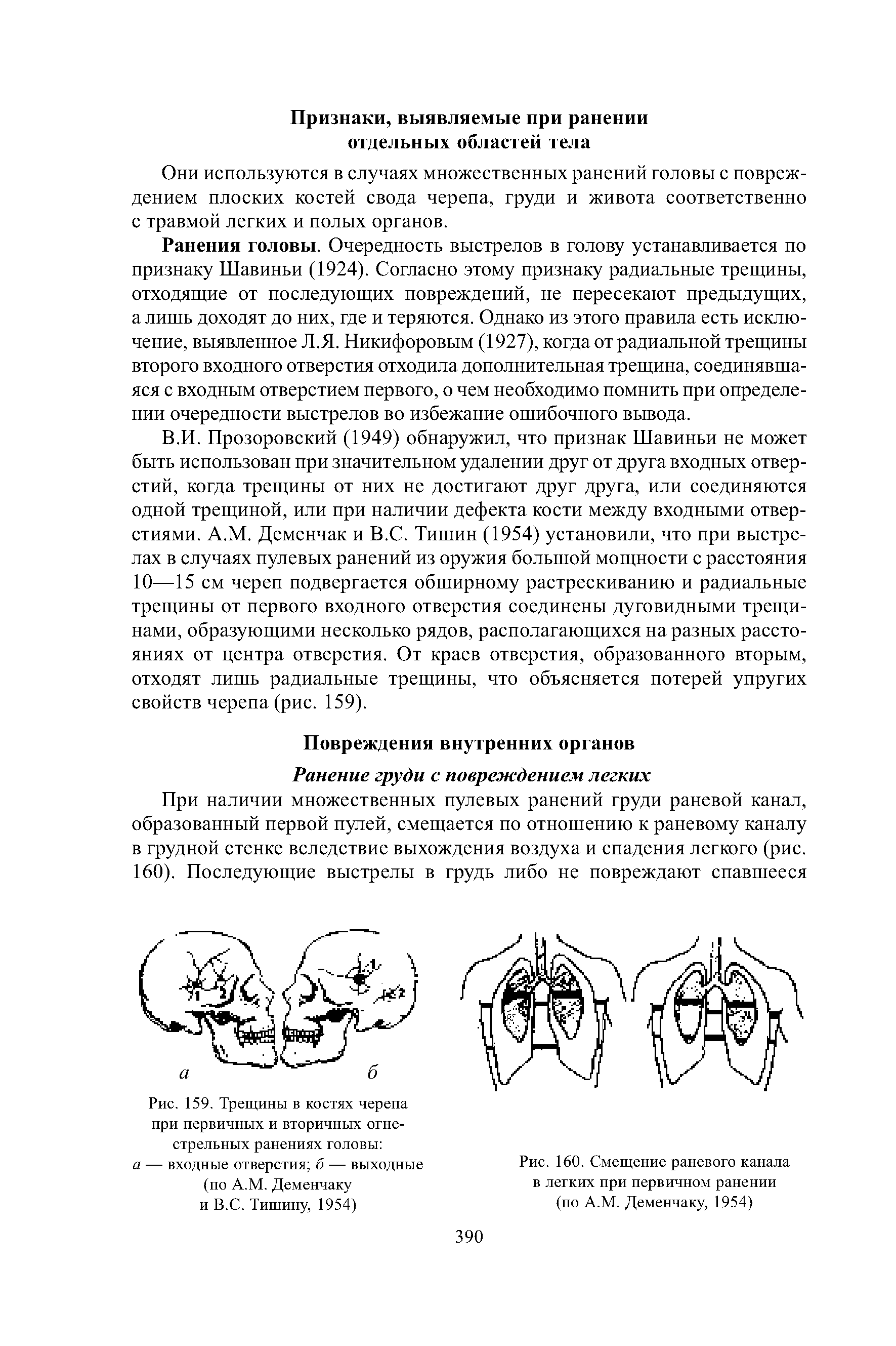 Рис. 159. Трещины в костях черепа при первичных и вторичных огнестрельных ранениях головы а — входные отверстия б — выходные (по А.М. Деменчаку и В.С. Тишину, 1954)...