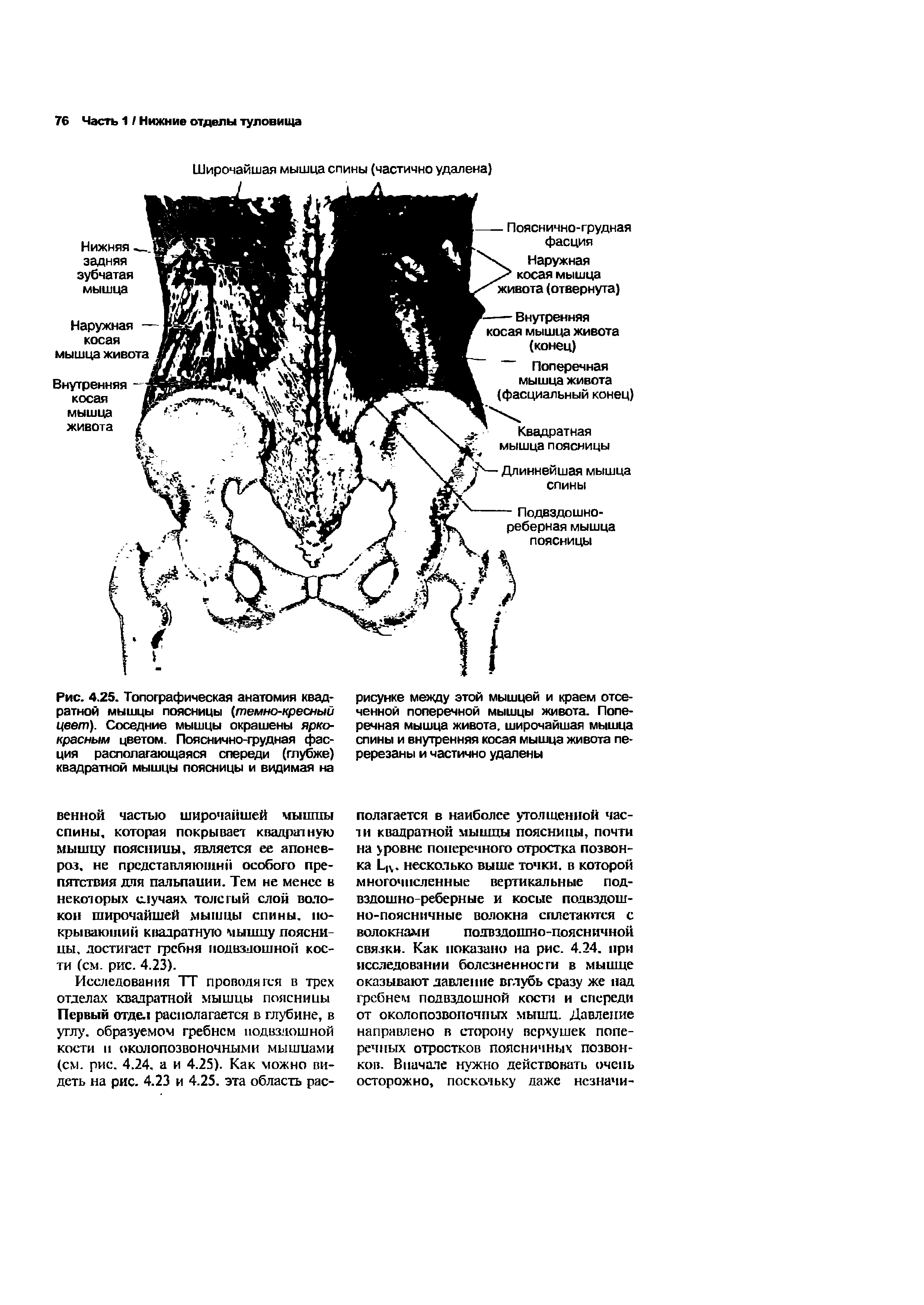 Рис. 4.25. Топографическая анатомия квадратной мышцы поясницы (темно-кресный цвет). Соседние мышцы окрашены ярко-красным цветом. Пояснично-грудная фасция располагающаяся спереди (глубже) квадратной мышцы поясницы и видимая на...