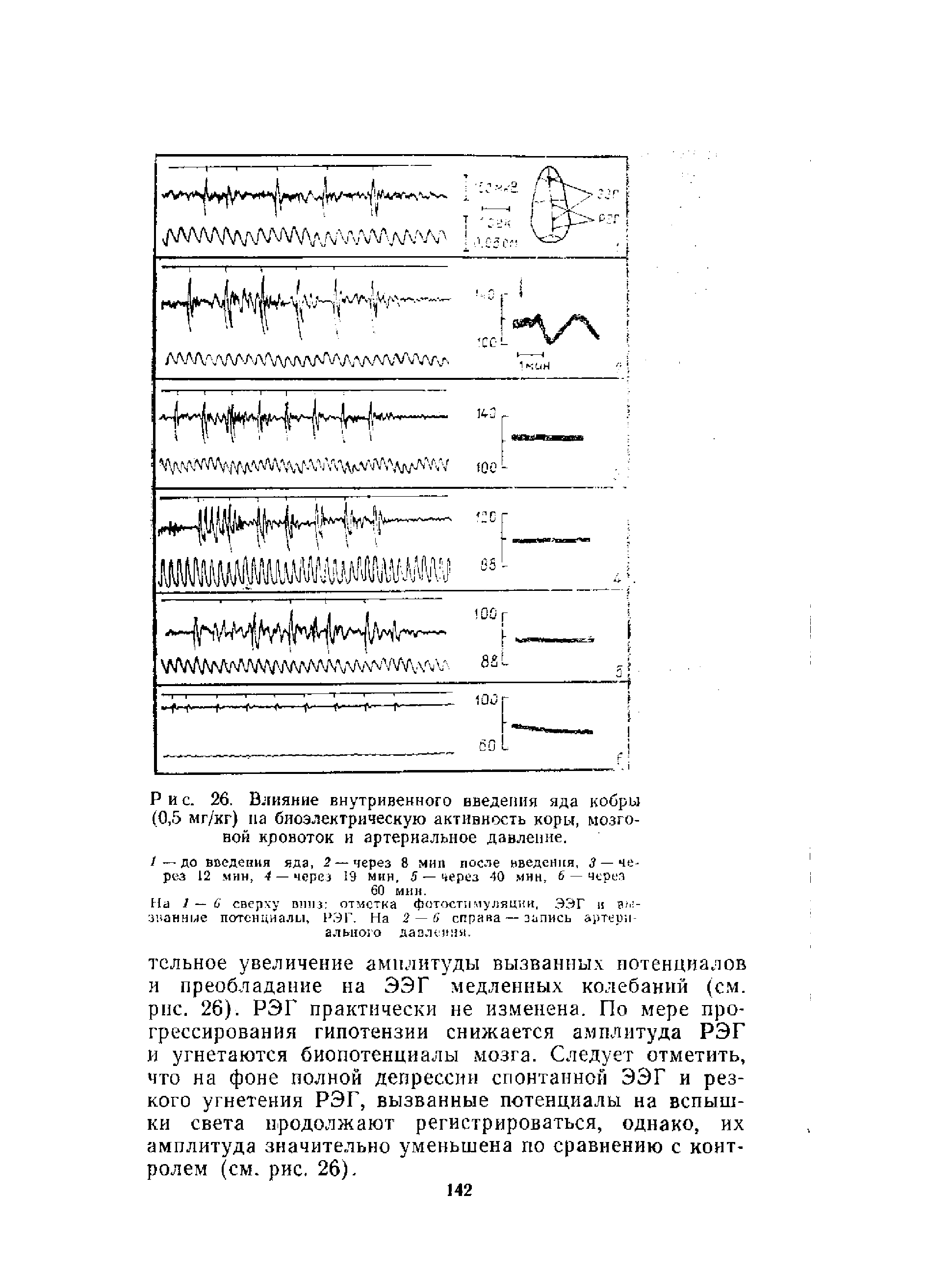 Рис. 26. Влияние внутривенного введения яда кобры (0,5 мг/кг) на биоэлектрическую активность коры, мозговой кровоток и артериальное давление.