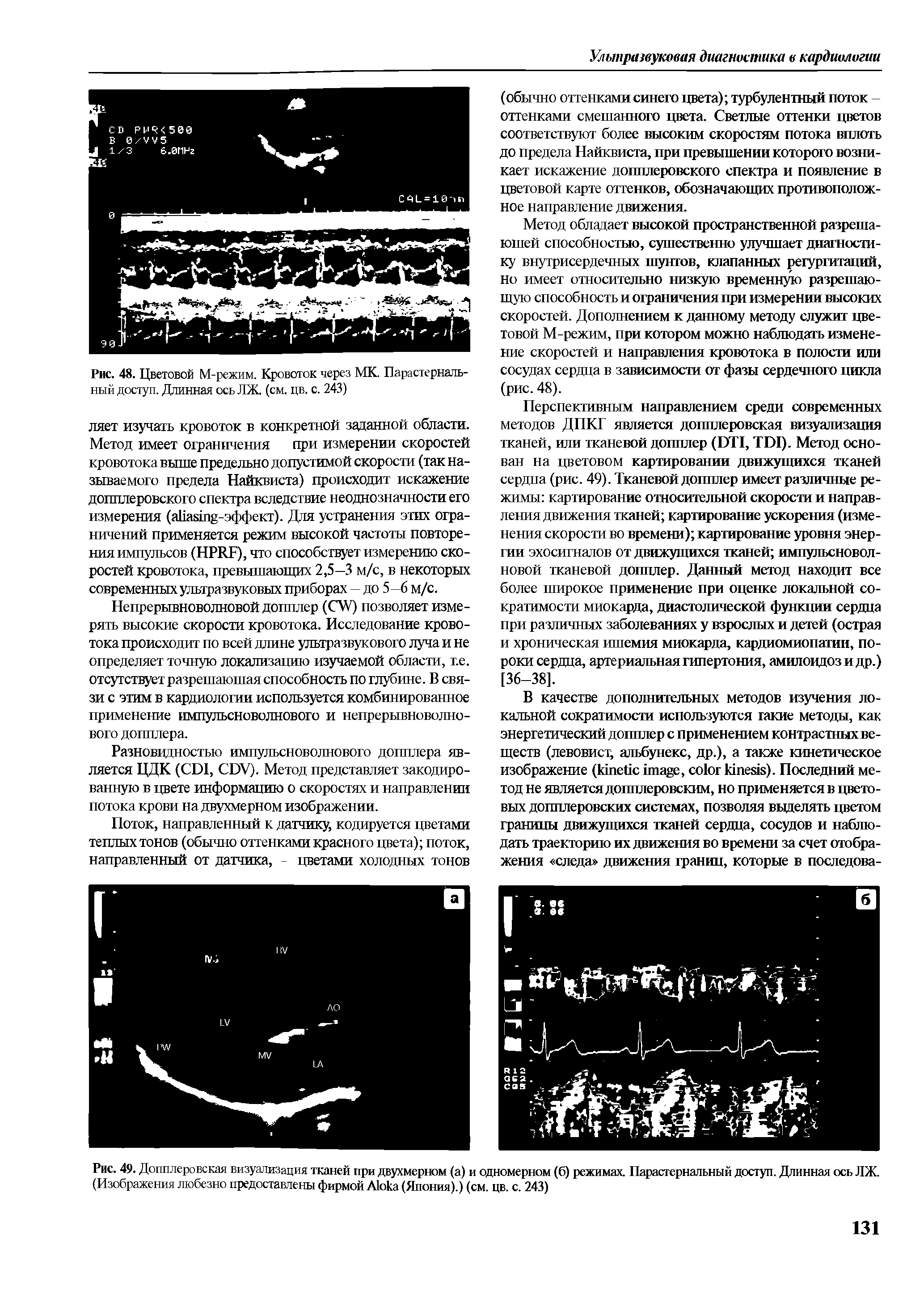 Рис. 49. Допплеровская визуализация тканей при двухмерном (а) и одномерном (б) режимах. Парастернальный доступ. Длинная ось ЛЖ. (Изображения любезно предоставлены фирмой А1ока (Япония).) (см. цв. с. 243)...