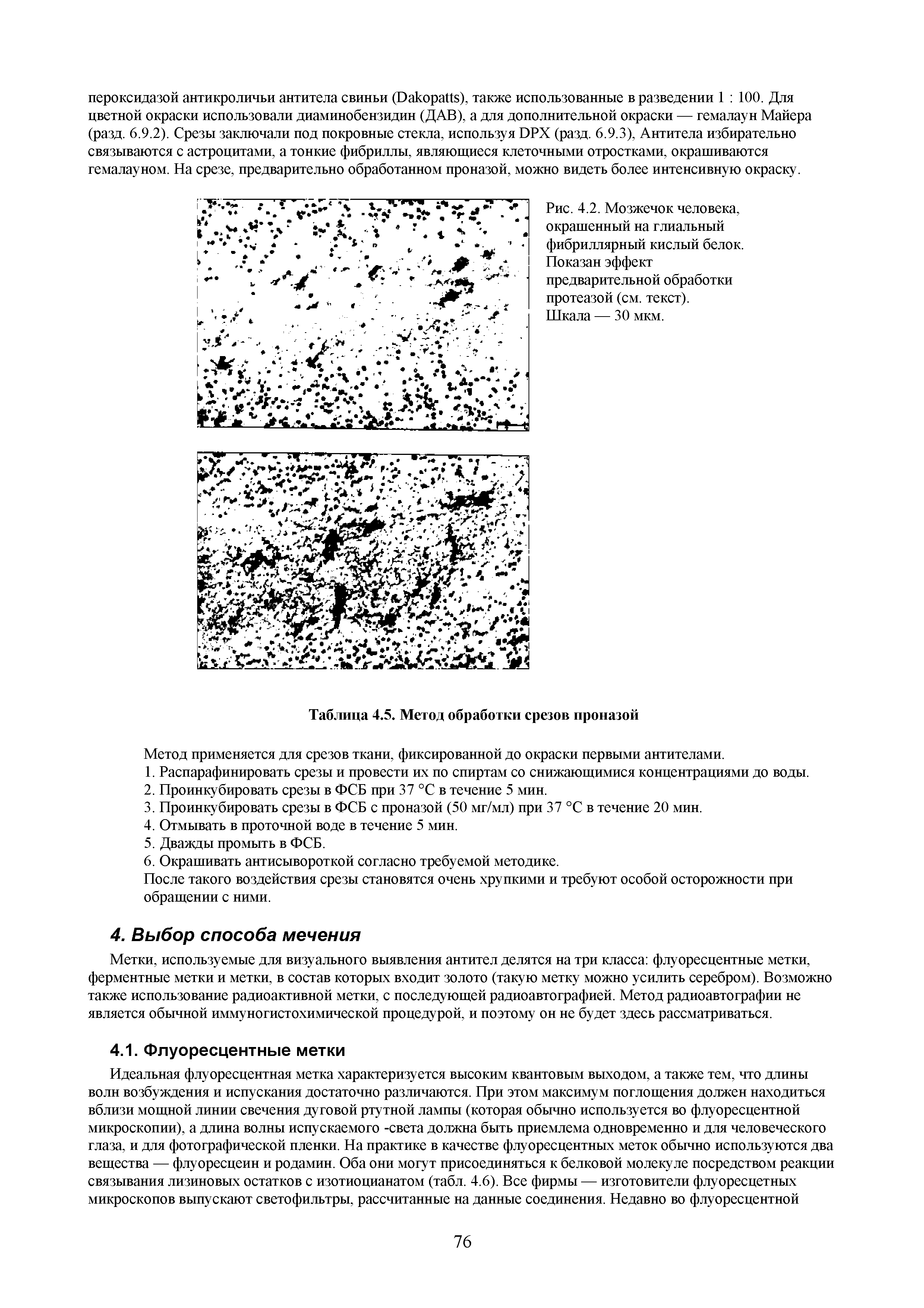 Рис. 4.2. Мозжечок человека, окрашенный на глиальный фибриллярный кислый белок. Показан эффект предварительной обработки протеазой (см. текст).