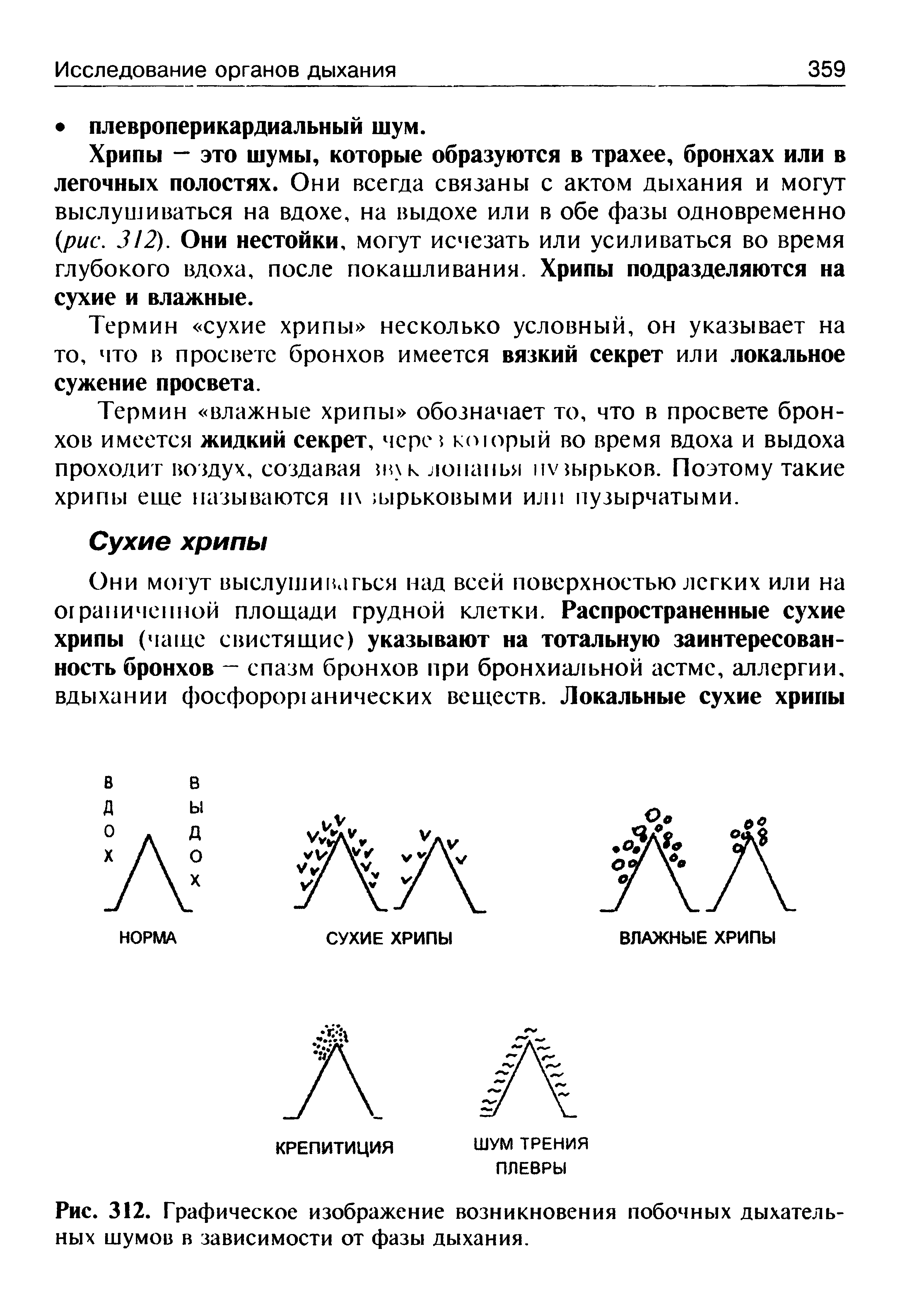 Рис. 312. Графическое изображение возникновения побочных дыхательных шумов в зависимости от фазы дыхания.