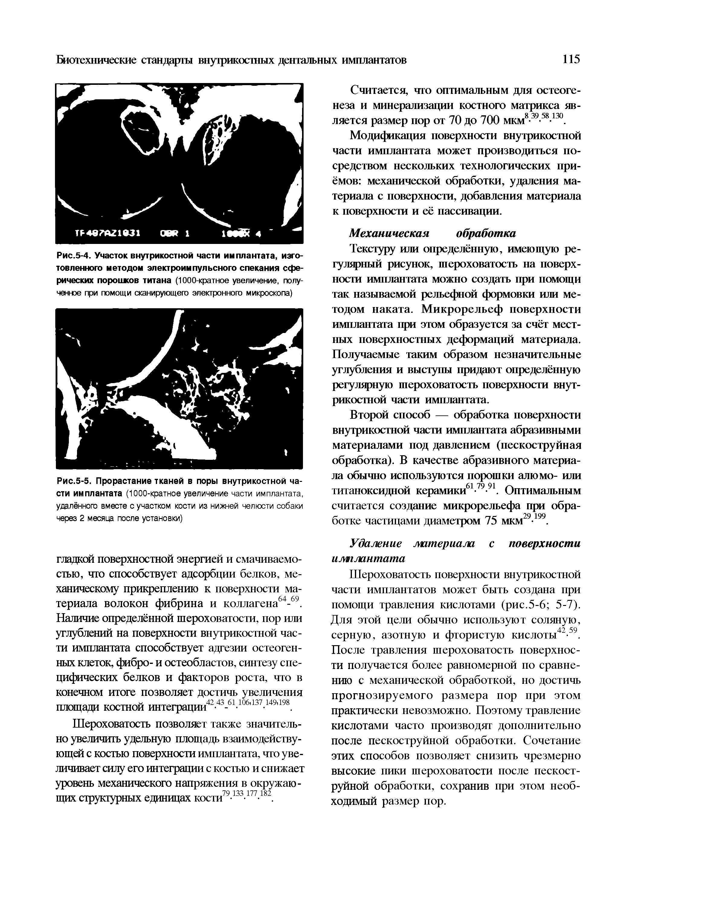 Рис.5-5. Прорастание тканей в поры внутрикостной части имплантата (1000-кратное увеличение части имплантата, удалённого вместе с участком кости из нижней челюсти собаки через 2 месяца после установки)...