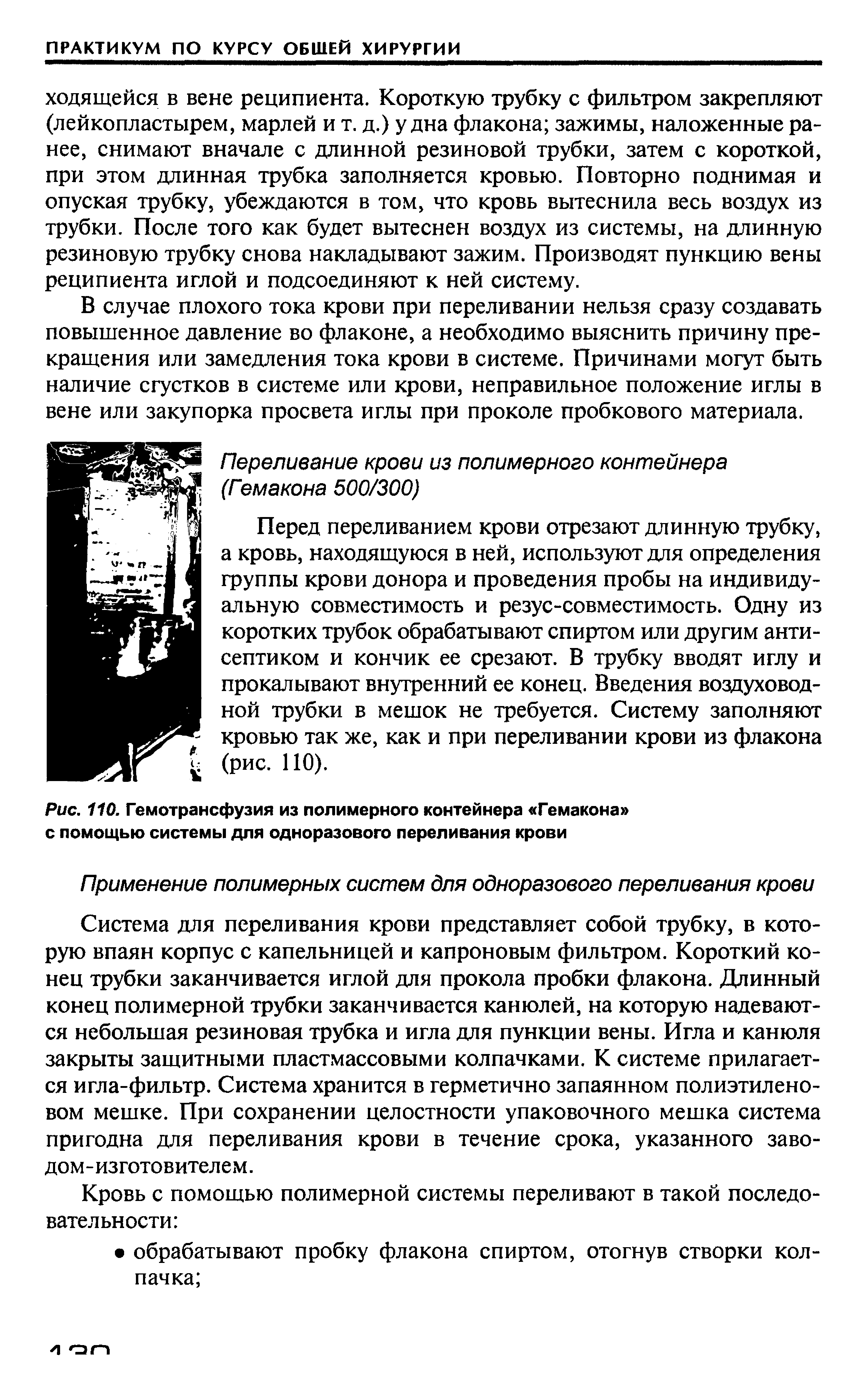 Рис. 110. Гемотрансфузия из полимерного контейнера Гемакона с помощью системы для одноразового переливания крови...