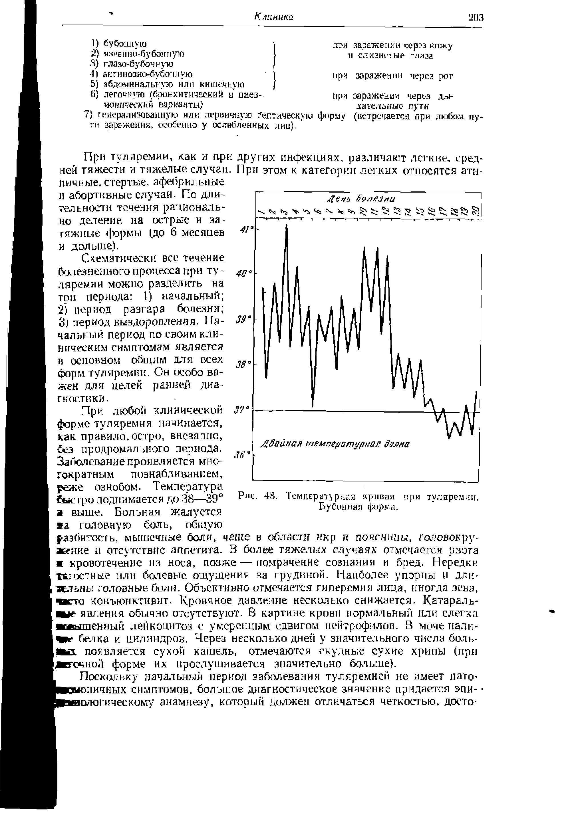 Рис. 48. Темпериту рная кривая при туляремии. Бубонная форма.