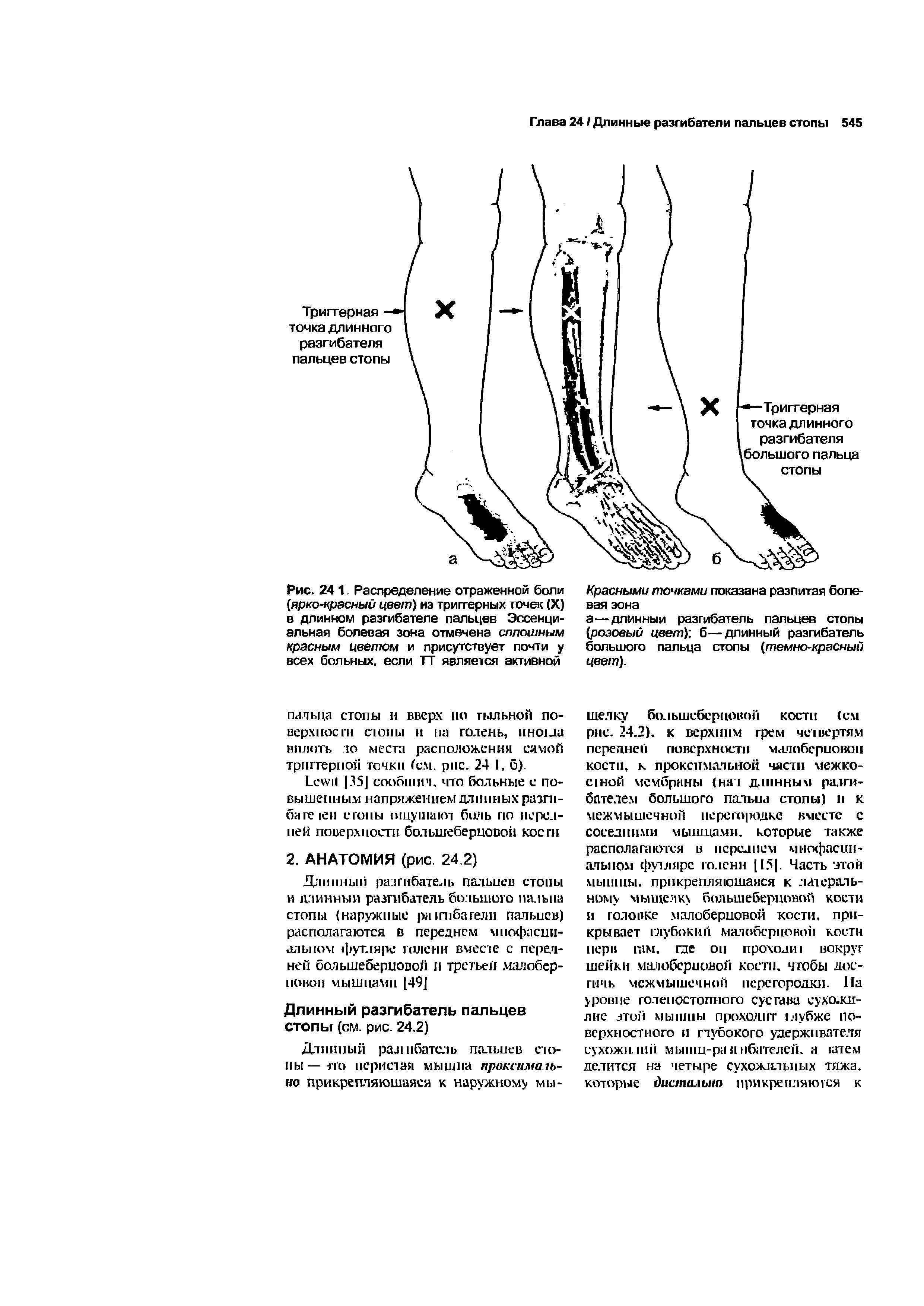 Рис. 241. Распределение отраженной боли [ярко-красный цвет) из триггерных точек (X) в длинном разгибателе пальцев Эссенциальная болевая зона отмечена сплошным красным цветом и присутствует почти у всех больных, если ТТ является активной...