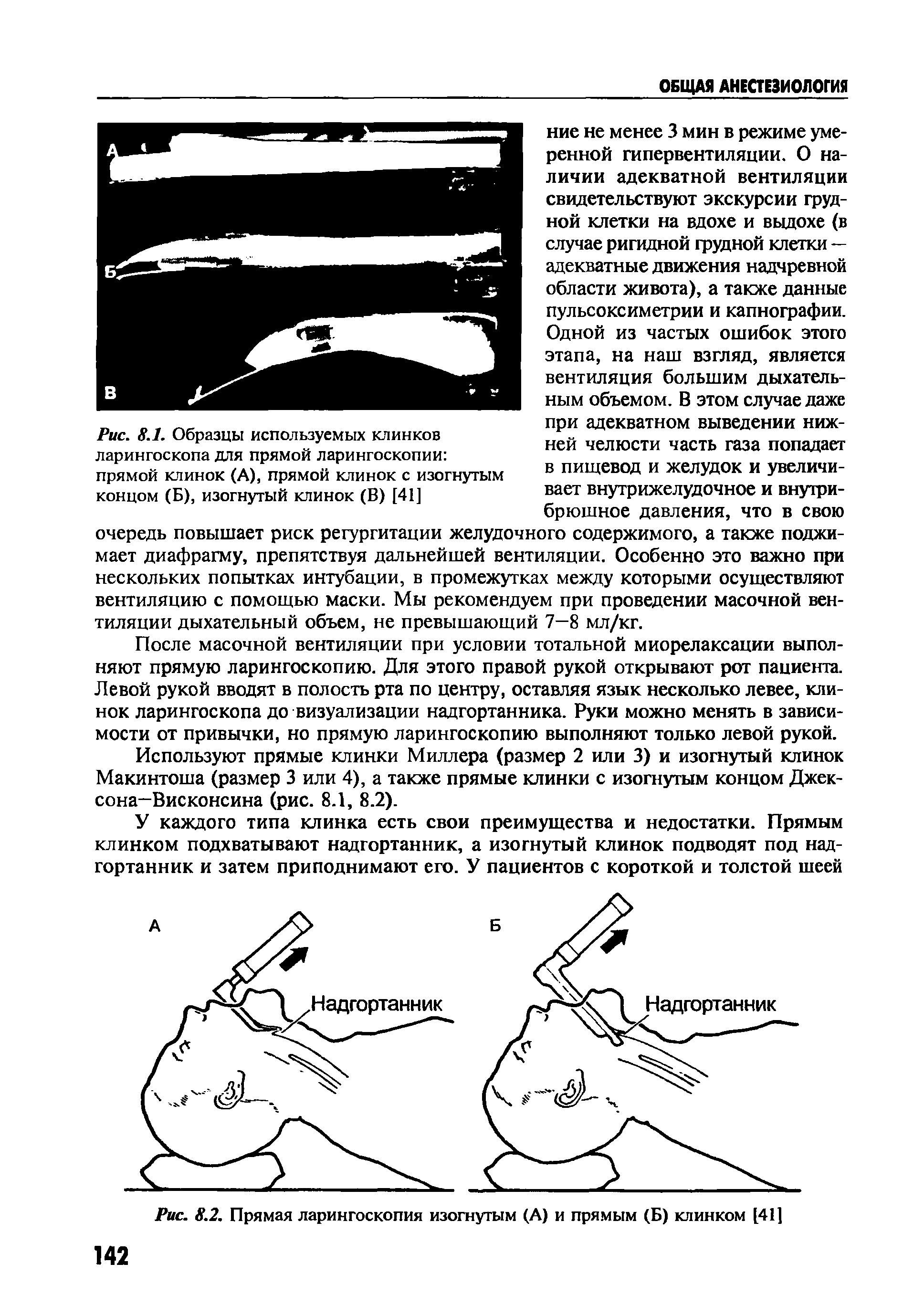 Рис. 8.1. Образцы используемых клинков ларингоскопа для прямой ларингоскопии прямой клинок (А), прямой клинок с изогнутым концом (Б), изогнутый клинок (В) [41]...