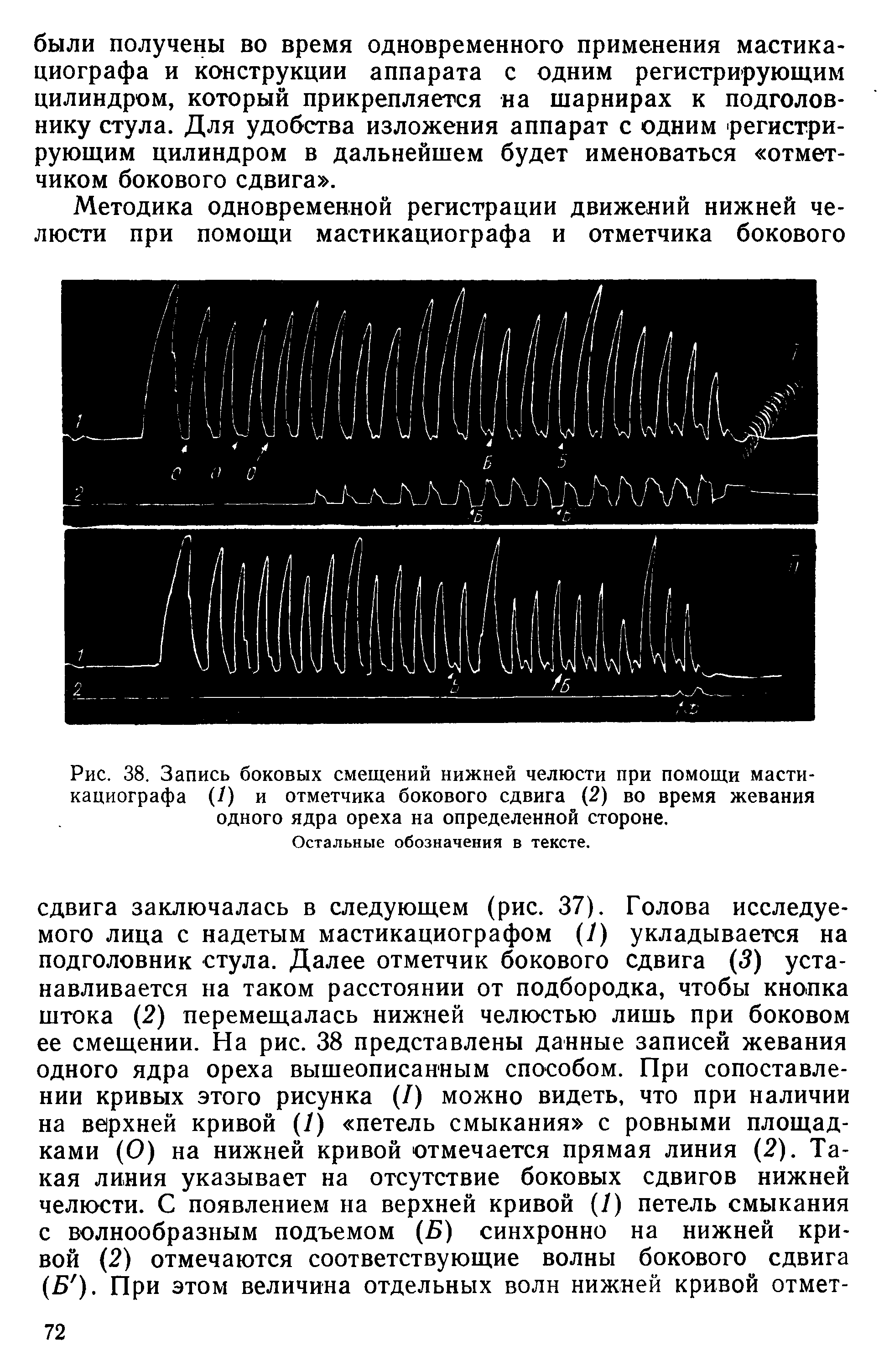 Рис. 38. Запись боковых смещений нижней челюсти при помощи мастикациографа (/) и отметчика бокового сдвига (2) во время жевания одного ядра ореха на определенной стороне.