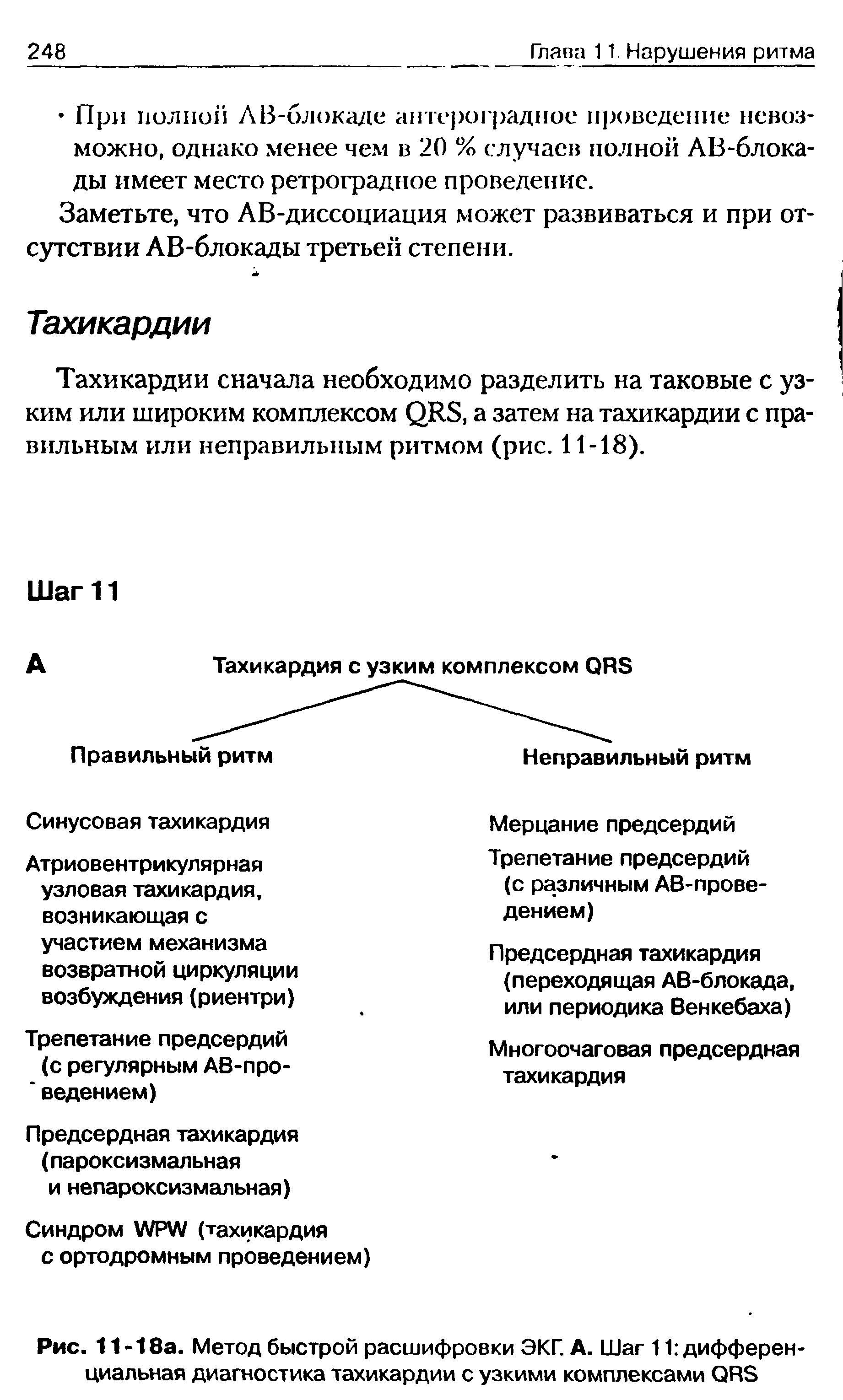 Рис. 11-18а. Метод быстрой расшифровки ЭКГ. А. Шаг 11 дифферен циальная диагностика тахикардии с узкими комплексами ОВв...