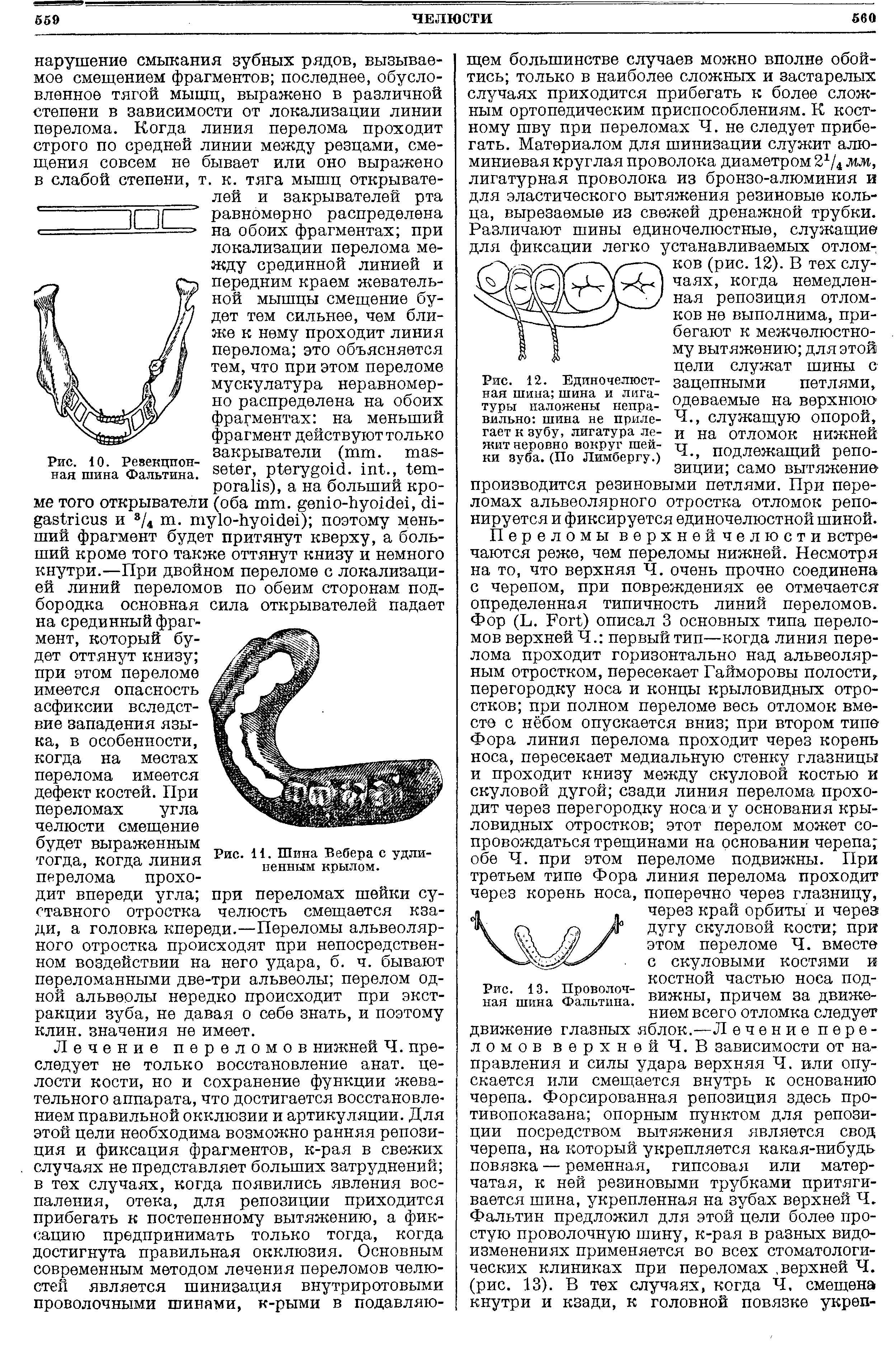 Рис. 12. Единочелюст- зацепными петлями, ная шина, шина и лиги- пттапярмьта ття пйт пстттою туры наложены непра- 0Д0ва0мые на верхнюю вильно шина не приле- Ч., служащую опорой, гает к зубу, лигатура ле- и на ОТЛОМОК нижней жит неровно вокруг шеи- тт...