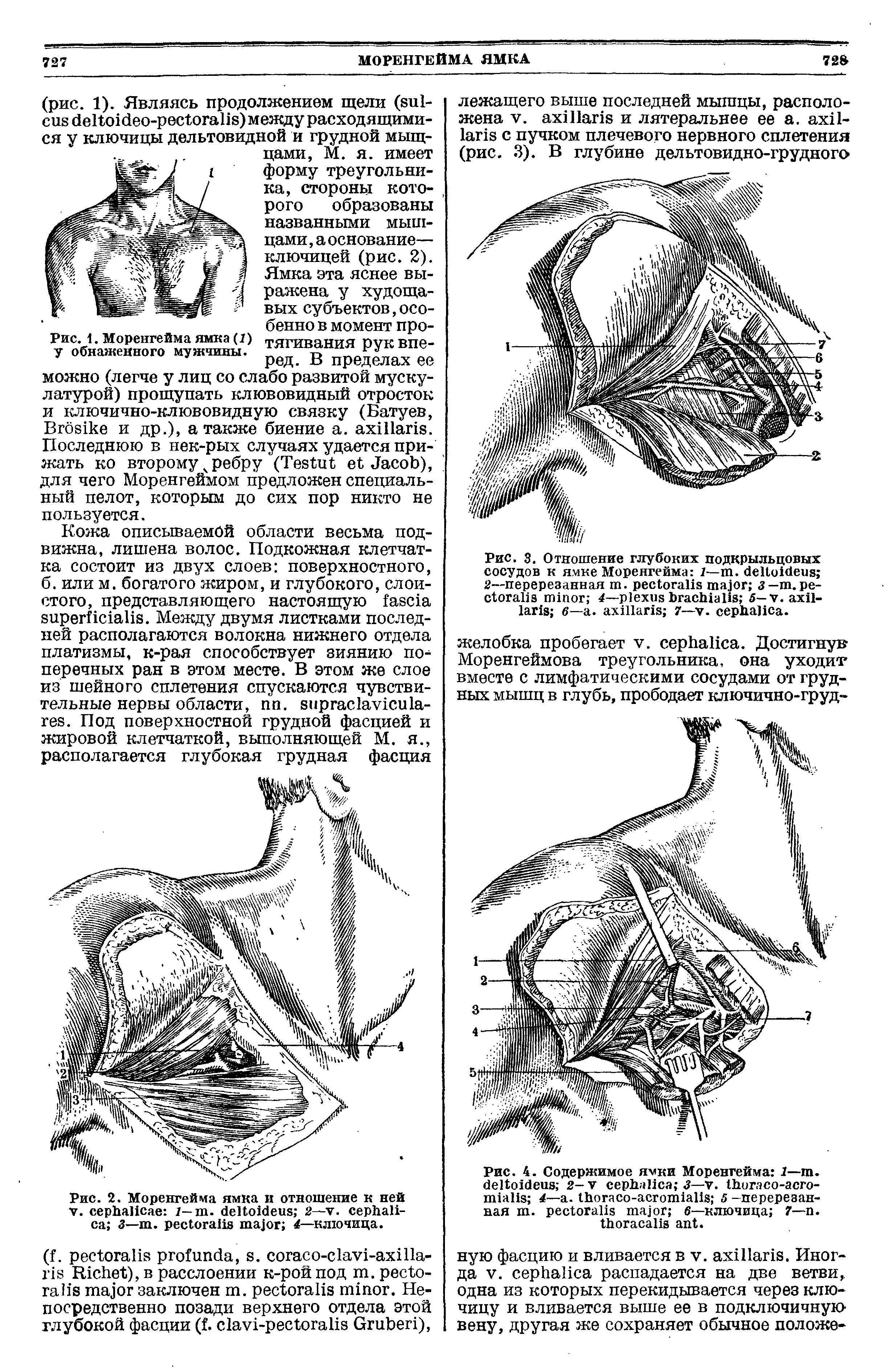 Рис. 2. Моренгейма ямка и отношение к ней V. 1— . 2— . 3— . 4—ключица.