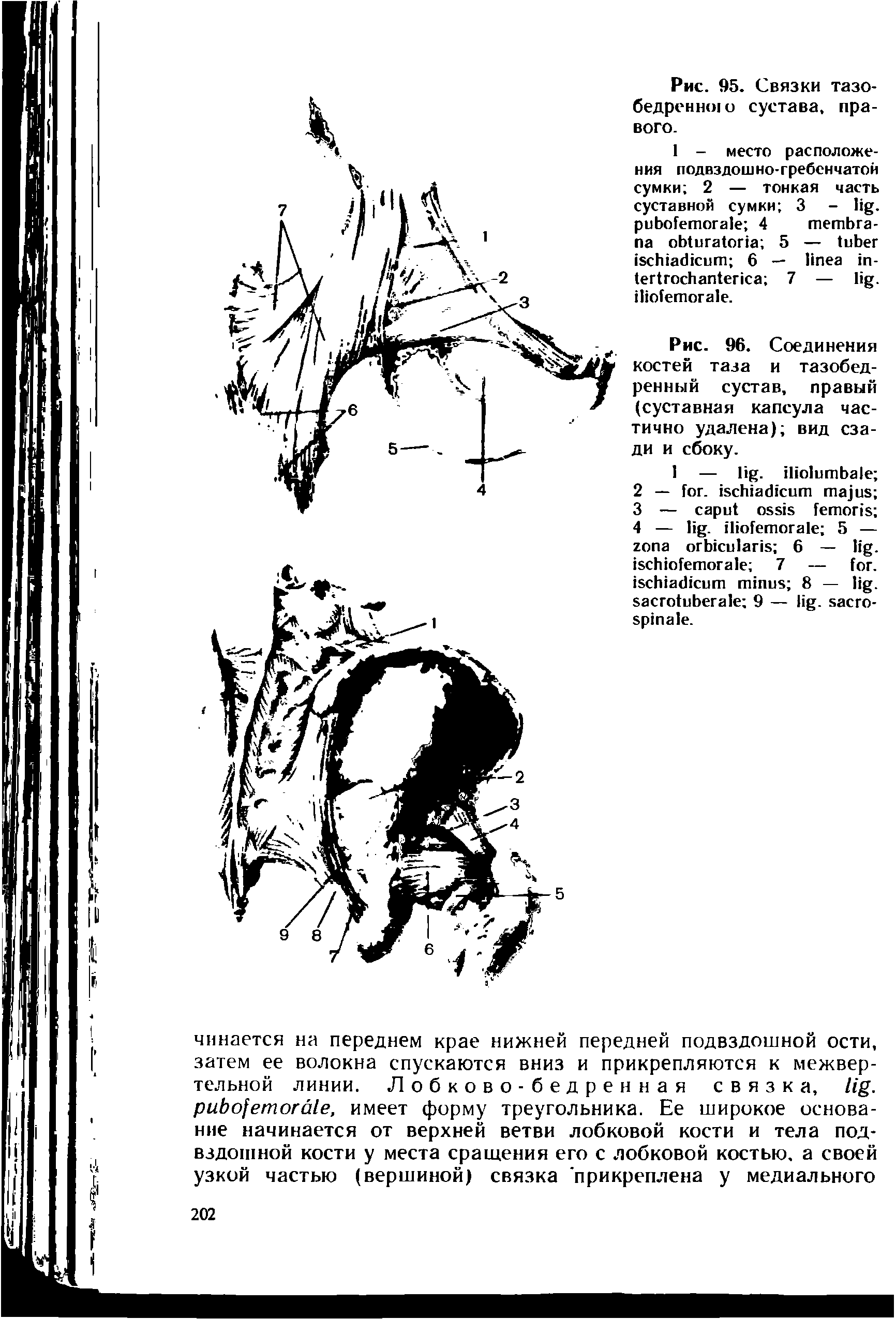 Рис. 96. Соединения костей таза и тазобедренный сустав, правый (суставная капсула частично удалена) вид сзади и сбоку.