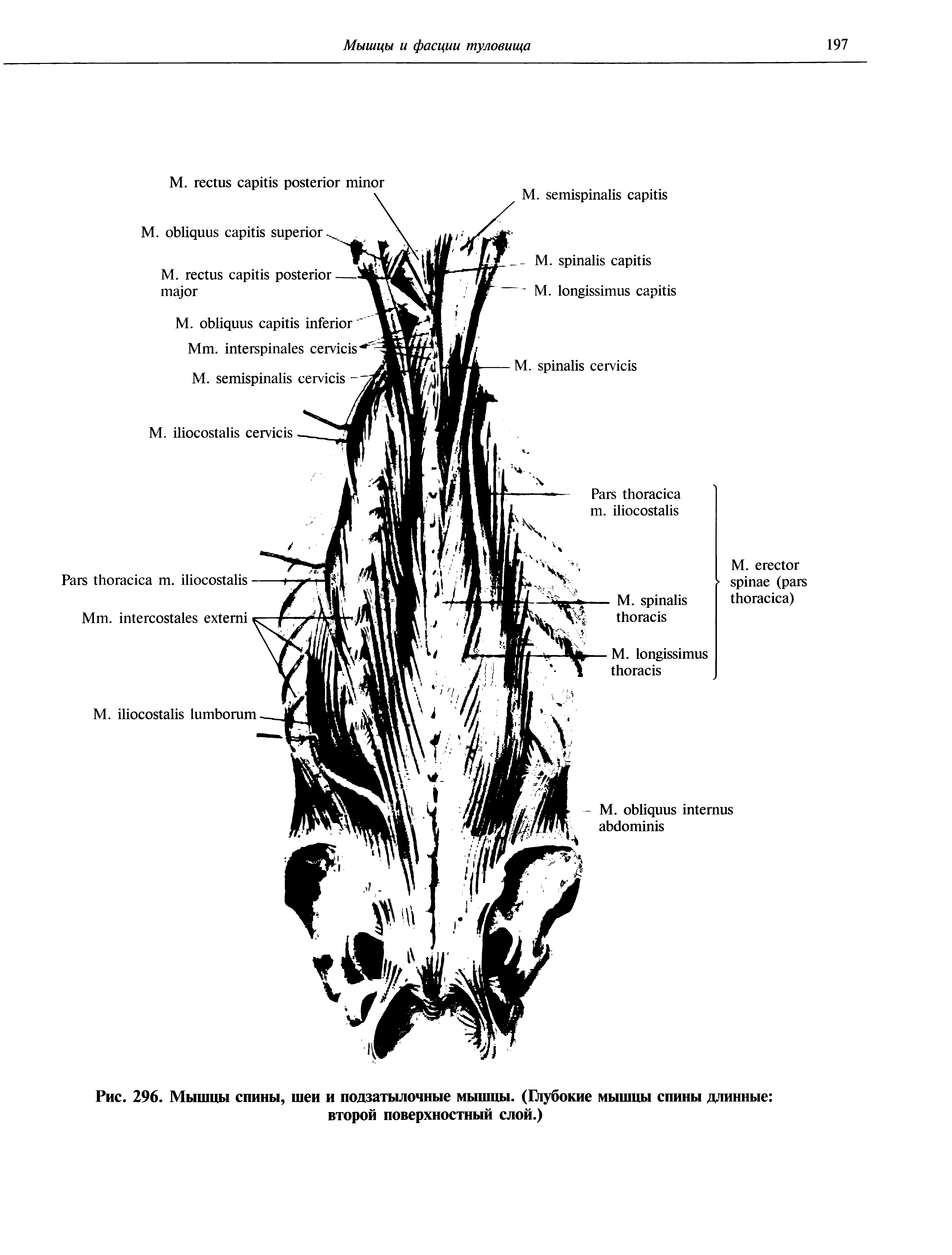 Рис. 296. Мышцы спины, шеи и подзатылочные мышцы. (Глубокие мышцы спины длинные второй поверхностный слой.)...