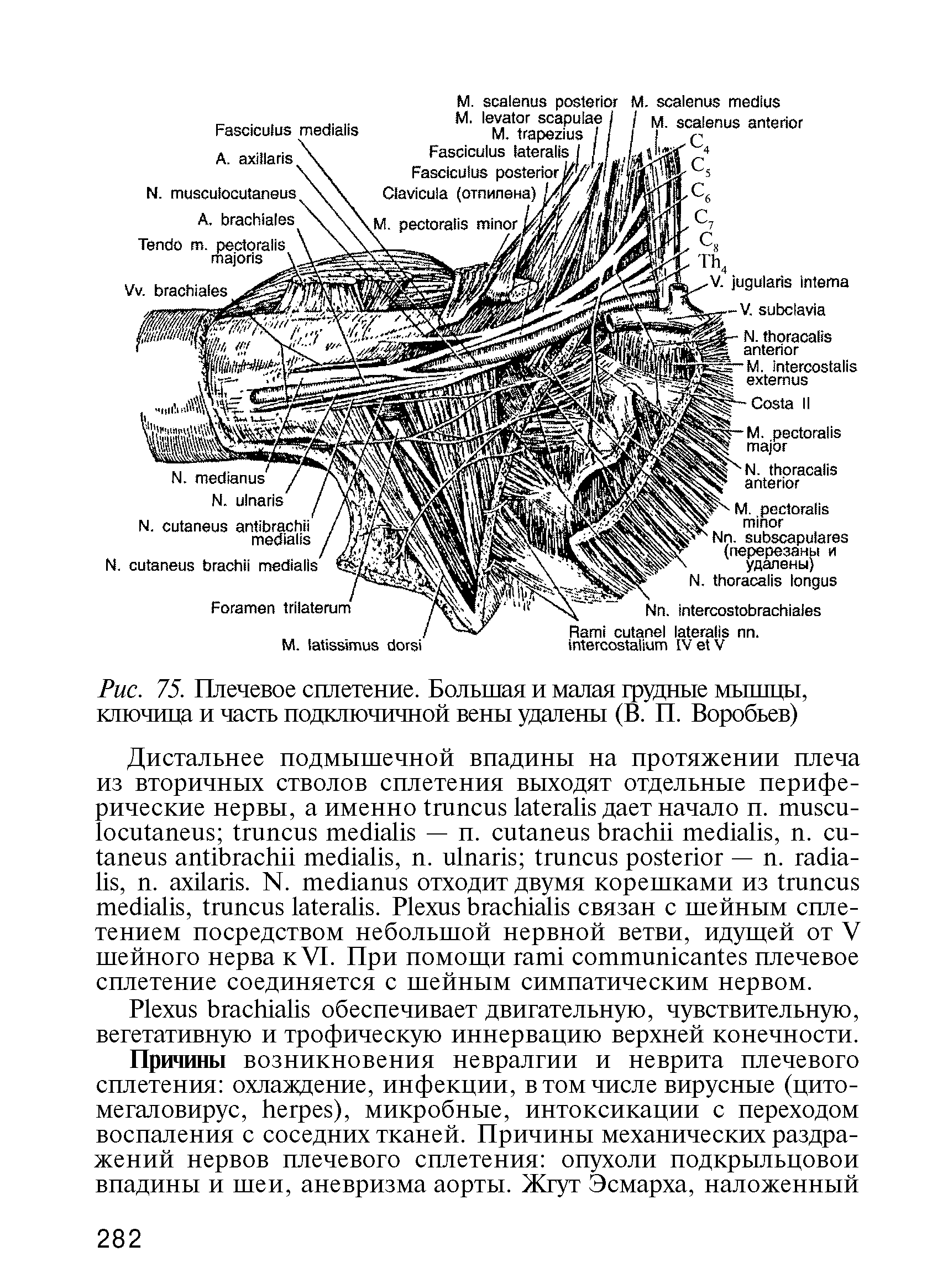 Рис. 75. Плечевое сплетение. Большая и малая грудные мышцы, ключица и часть подключичной вены удатены (В. П. Воробьев)...