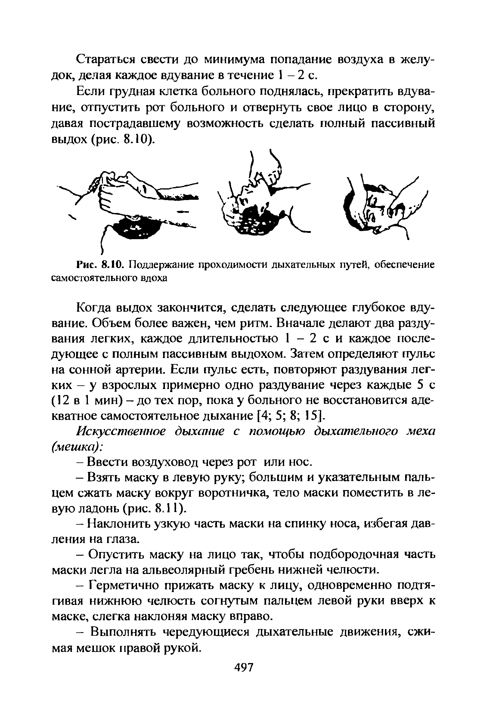 Рис. 8.10. Поддержание проходимости дыхательных путей, обеспечение самостоятельного вдоха...