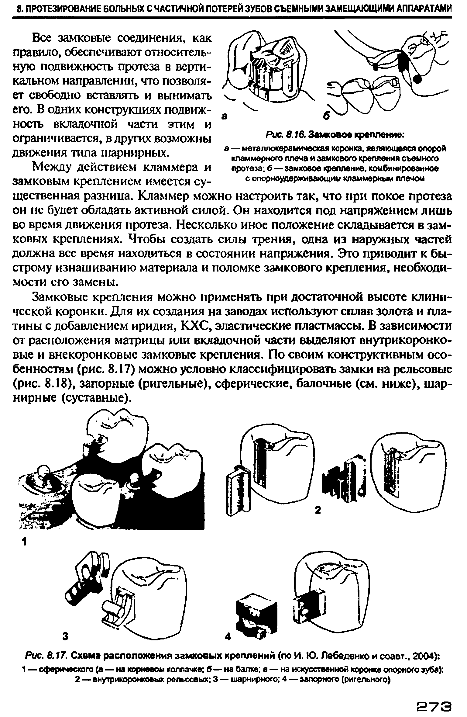 Рис. 8.17. Схема расположения замковых креплений (по И. Ю. Лебеденко и соавт., 2004) ...