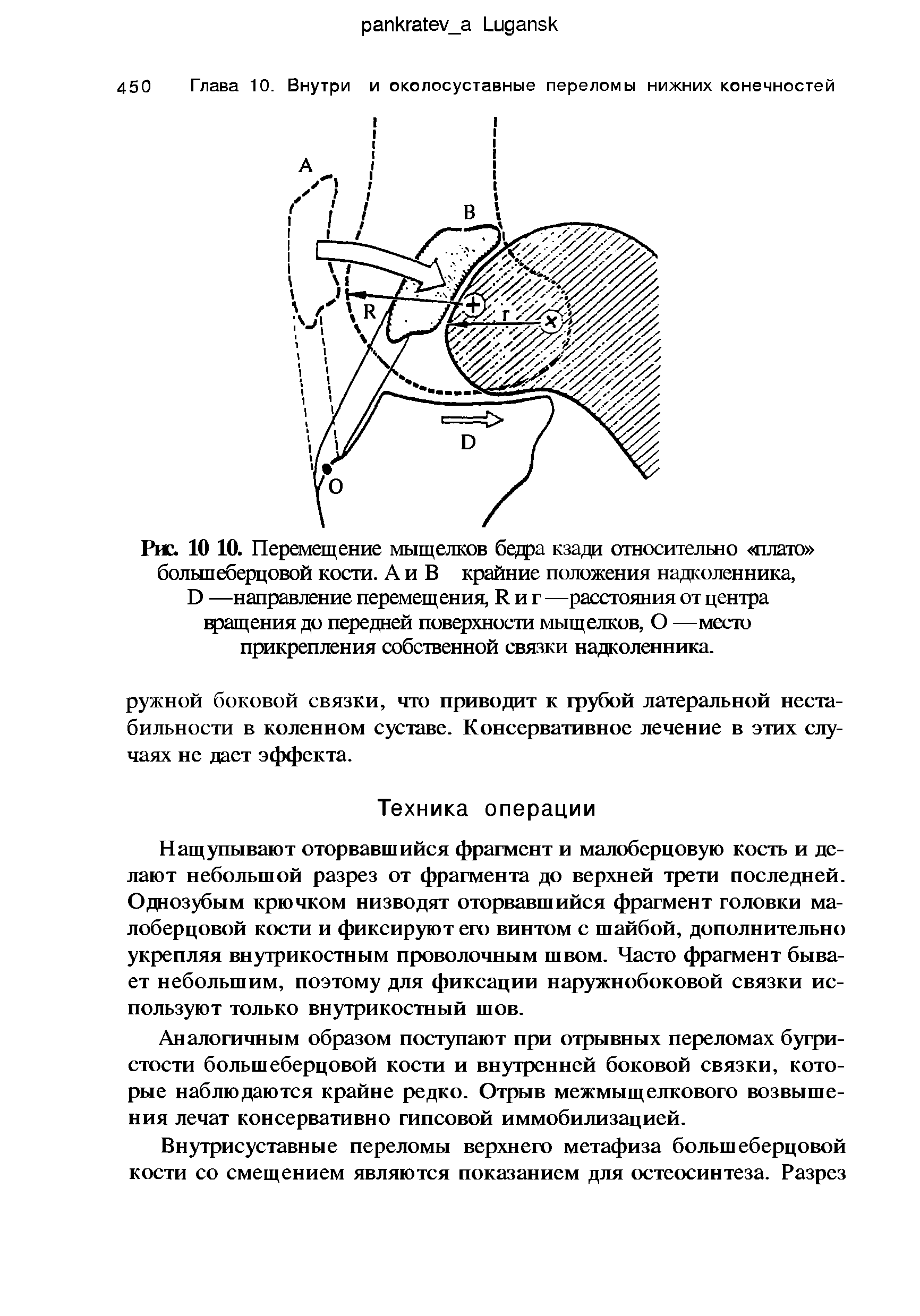 Рис. 10 10. Перемещение мыщелков бедра кзади относительно плато большеберцовой кости. А и В крайние положения надколенника, О —направление перемещения, И и г —расстояния от центра вращения до передней поверхности мыщелков, О —место прикрепления собственной связки надколенника.