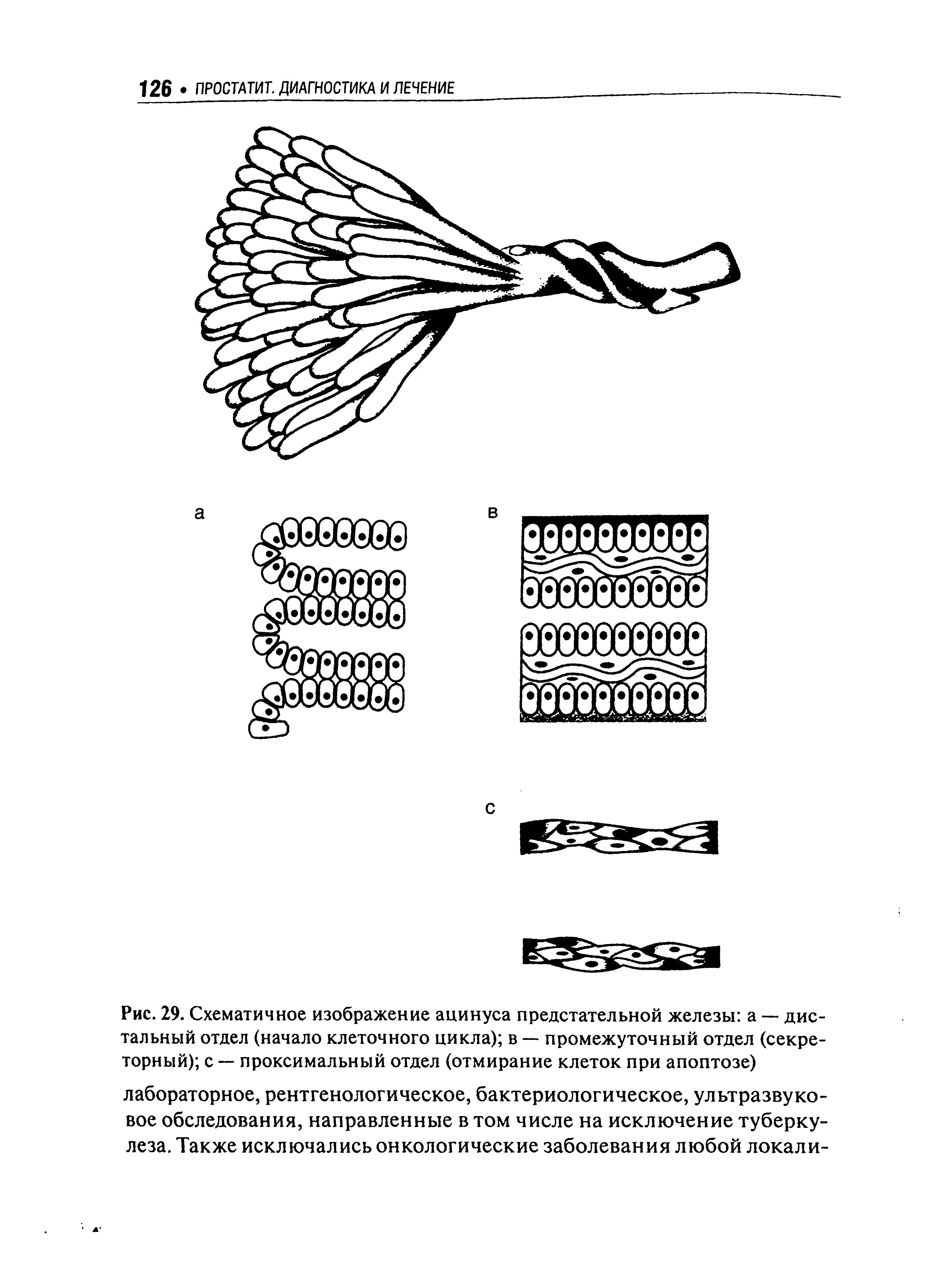 Рис. 29. Схематичное изображение ацинуса предстательной железы а — дистальный отдел (начало клеточного цикла) в — промежуточный отдел (секреторный) с — проксимальный отдел (отмирание клеток при апоптозе)...