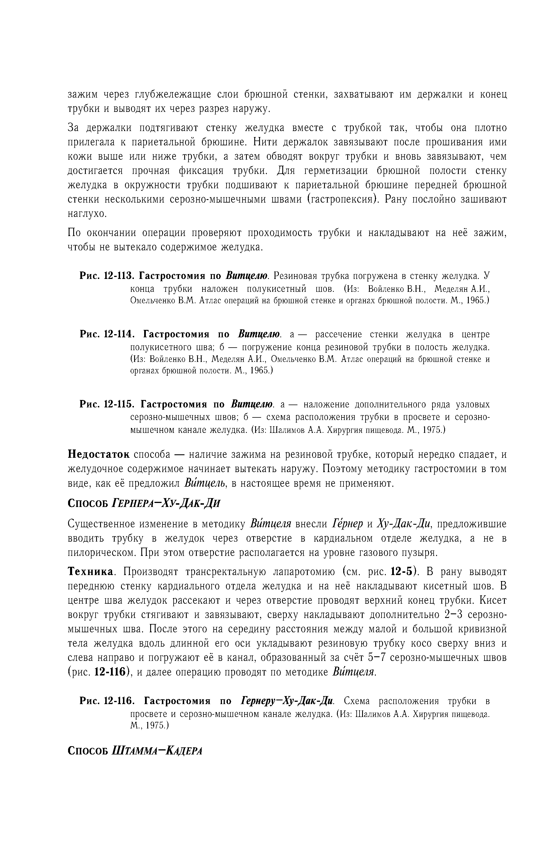 Рис. 12-115. Гастростомия по Витцелю. а — наложение дополнительного ряда узловых серозно-мышечных швов б — схема расположения трубки в просвете и серозномышечном канале желудка. (Из Шалимов А.А. Хирургия пищевода. М., 1975.)...