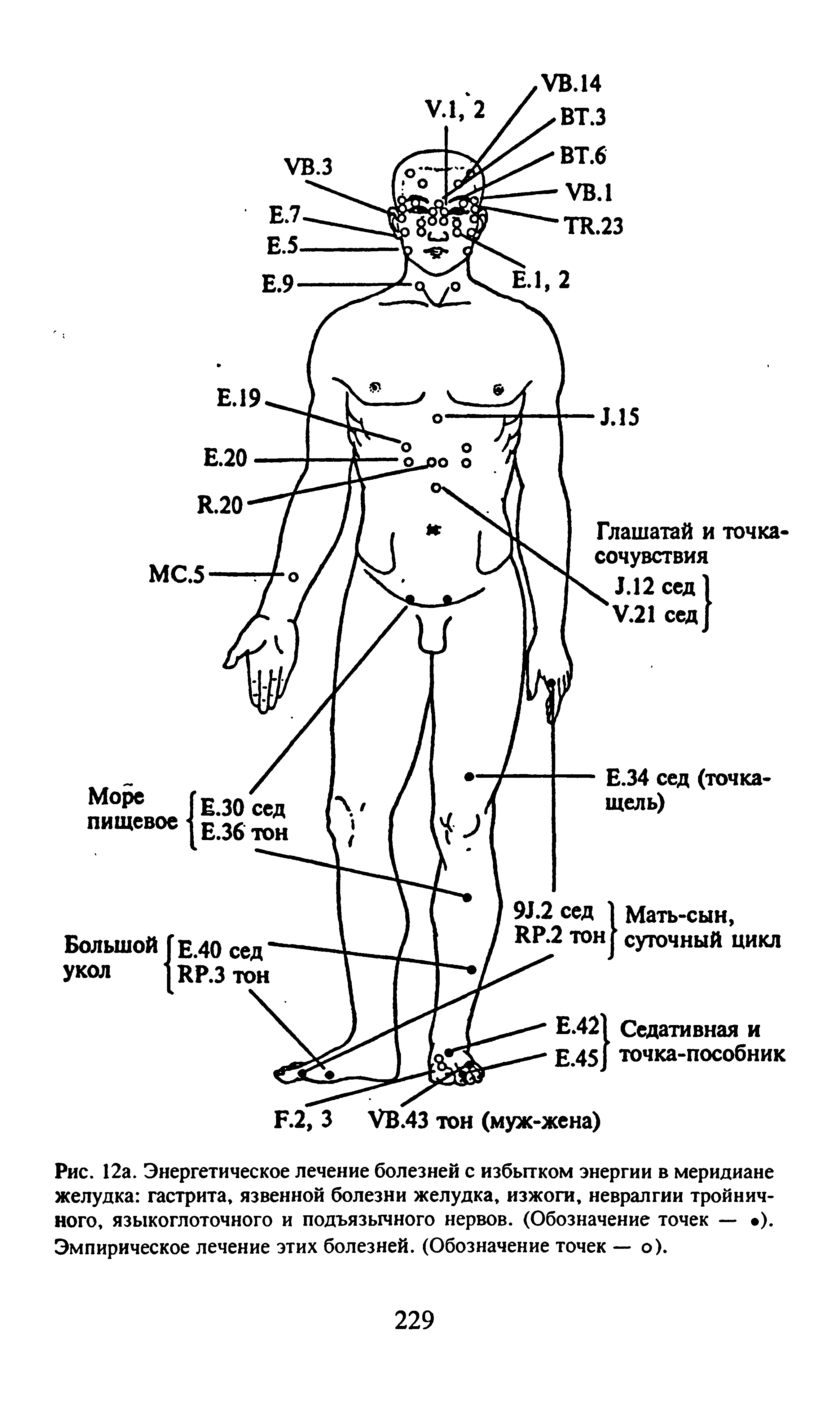 Рис. 12а. Энергетическое лечение болезней с избытком энергии в меридиане желудка гастрита, язвенной болезни желудка, изжоги, невралгии тройничного, языкоглоточного и подъязычного нервов. (Обозначение точек — ). Эмпирическое лечение этих болезней. (Обозначение точек — о).