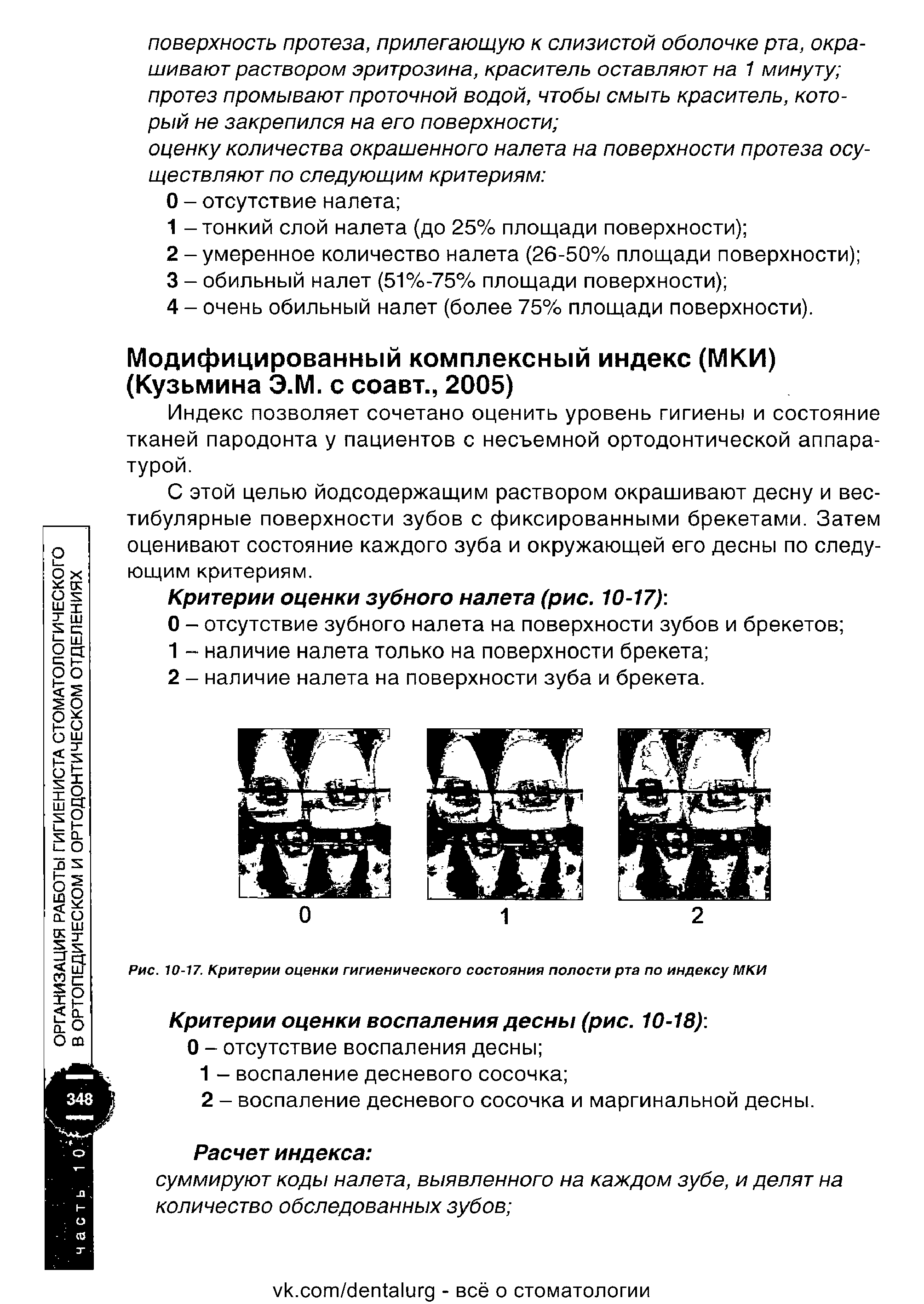 Рис. 10-17. Критерии оценки гигиенического состояния полости рта по индексу МКИ...