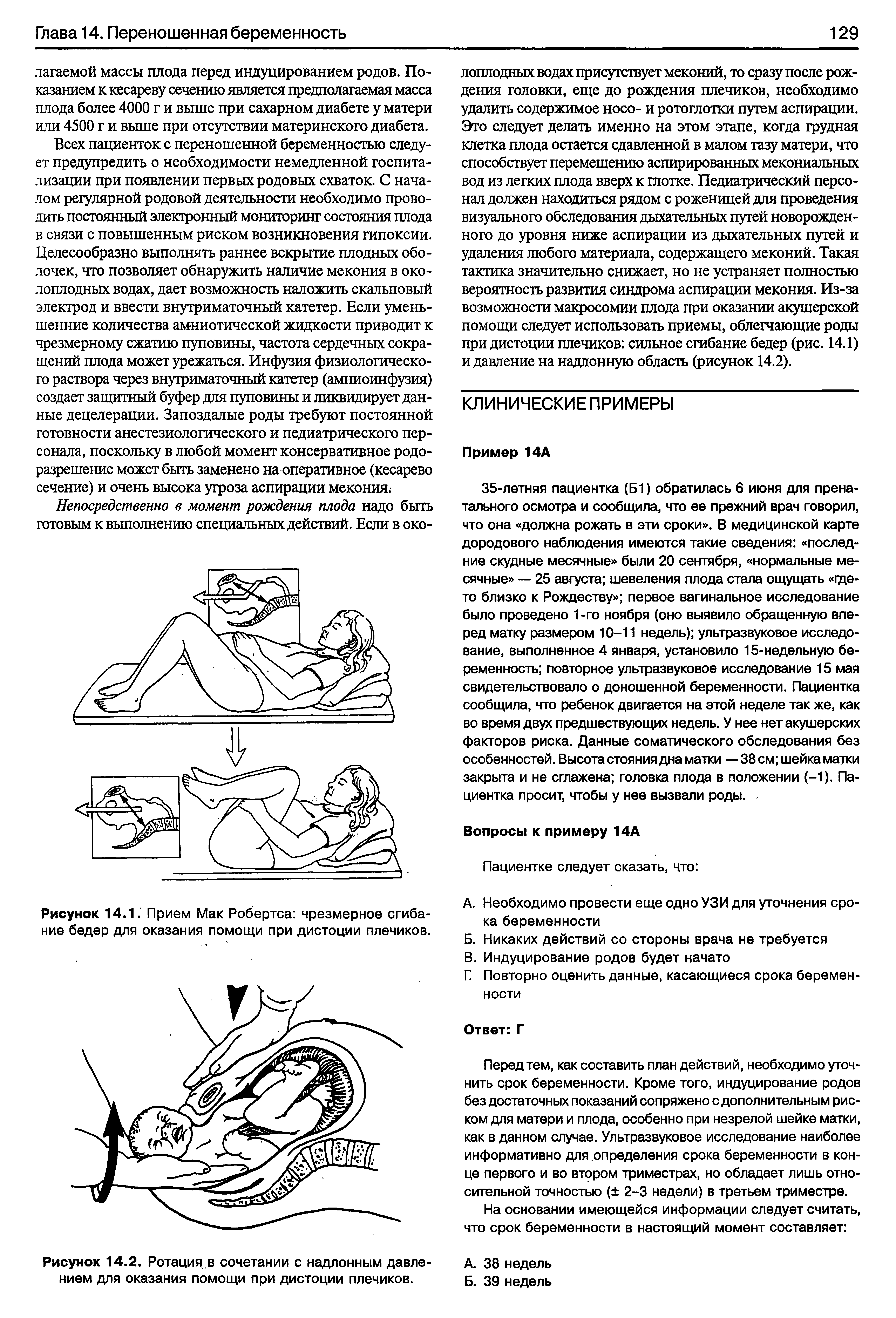 Рисунок 14.1. Прием Мак Робертса чрезмерное сгибание бедер для оказания помощи при дистоции плечиков.