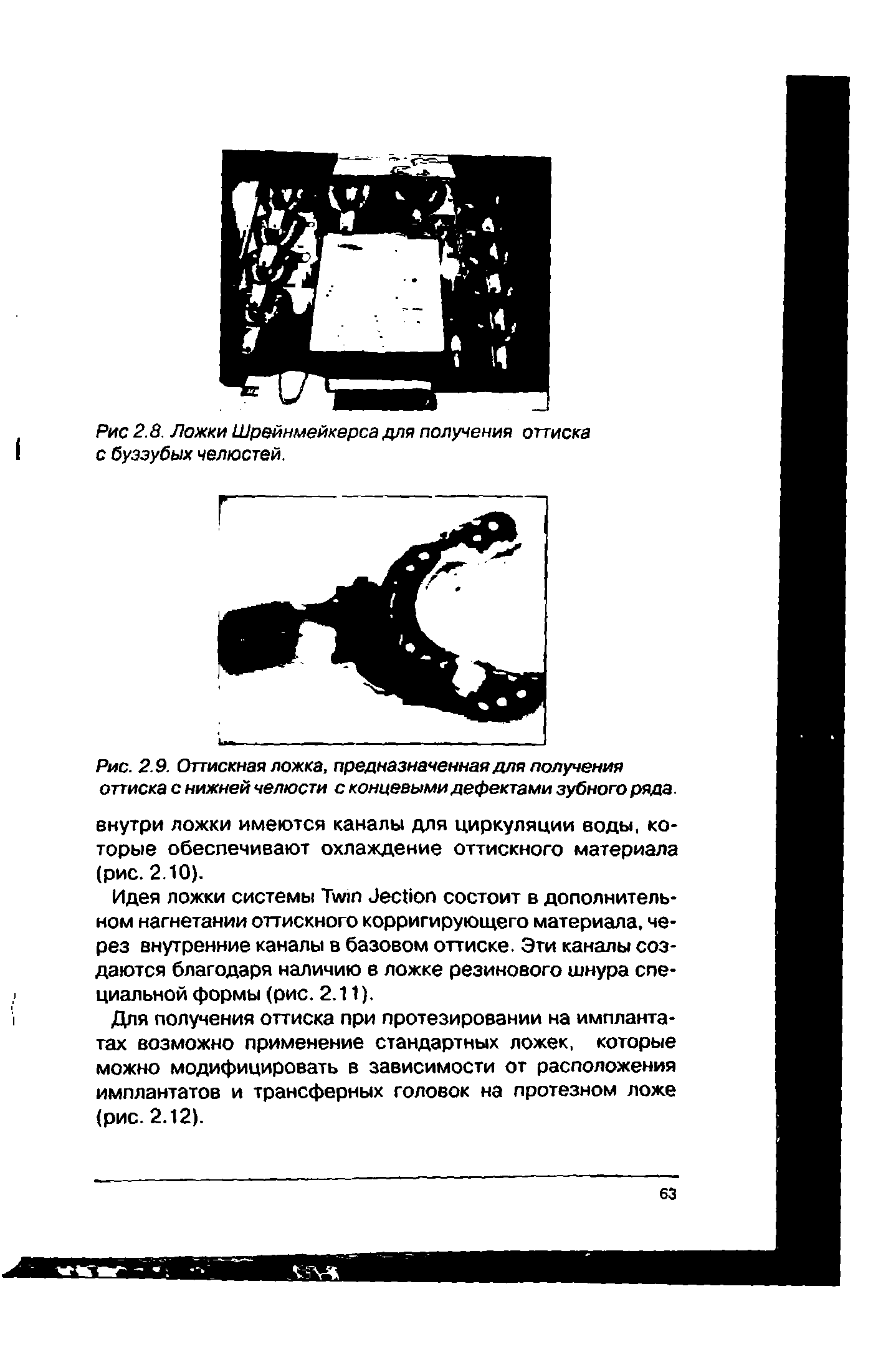 Рис. 2.9. Оттискная ложка, предназначенная для получения оттиска с нижней челюсти с концевыми дефектами зубного ряда.