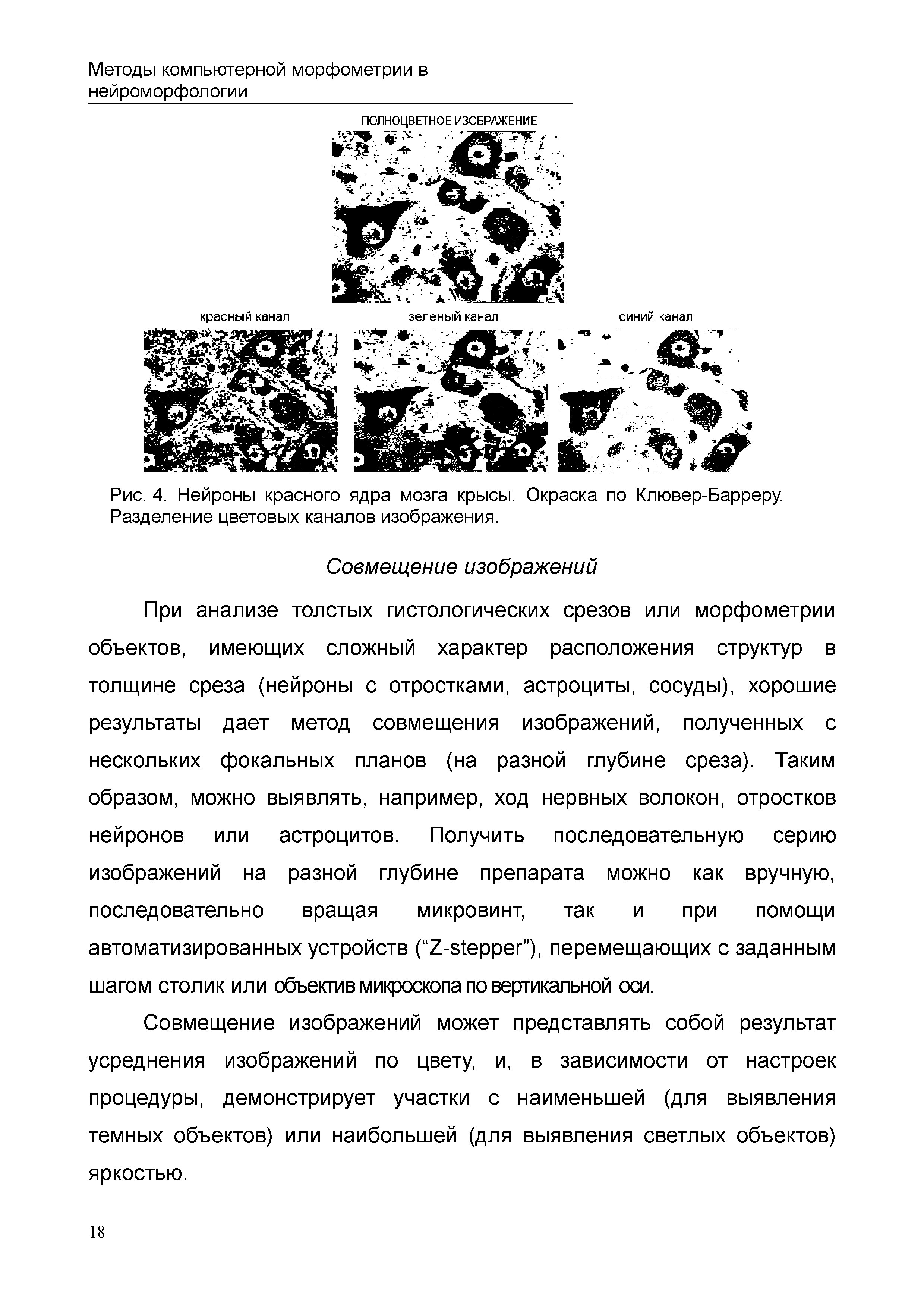 Рис. 4. Нейроны красного ядра мозга крысы. Окраска по Клювер-Барреру. Разделение цветовых каналов изображения.