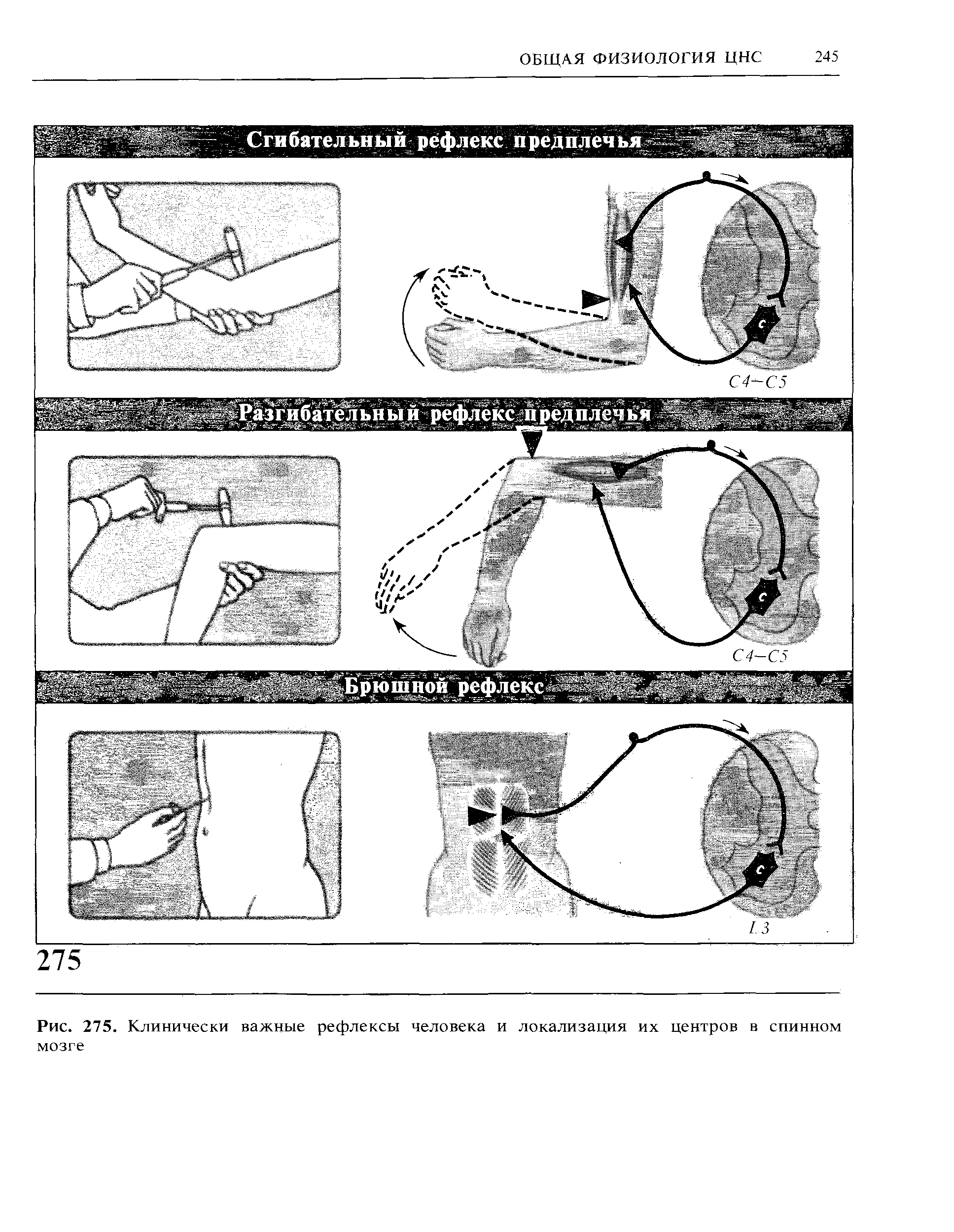 Рис. 275. Клинически важные рефлексы человека и локализация их центров в спинном мозге...