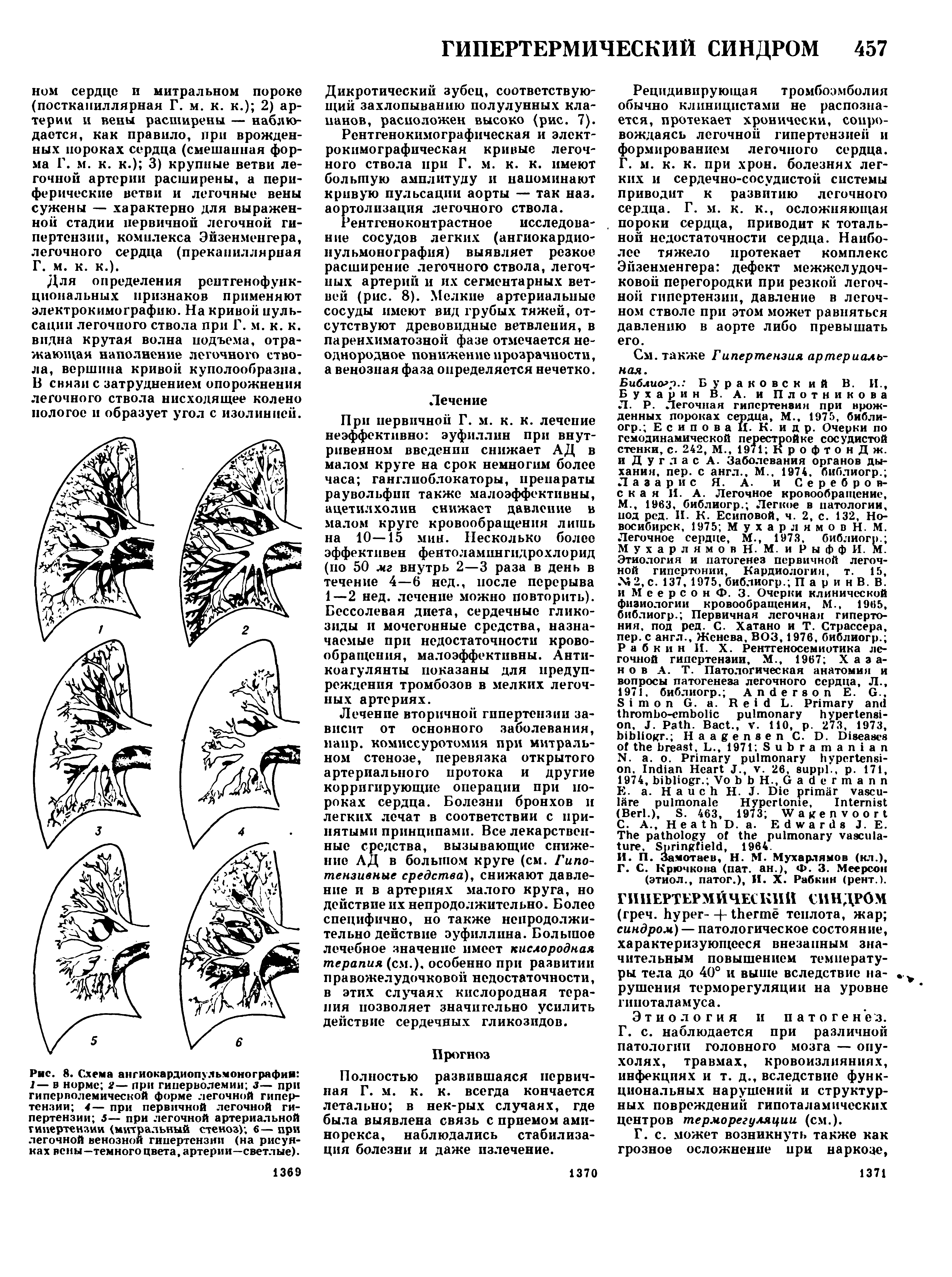 Рис. 8. Схема ангиокардиопульмонографин 1— в норме 2— при гиперволемии з— при гиперволемической форме легочной гипертензии 4— при первичной легочной гипертензии 5— при легочной артериальной гипертензии (митральный стеноз) 6— при легочной венозной гипертензии (на рисунках вены—темного цвета, артерии—светлые).