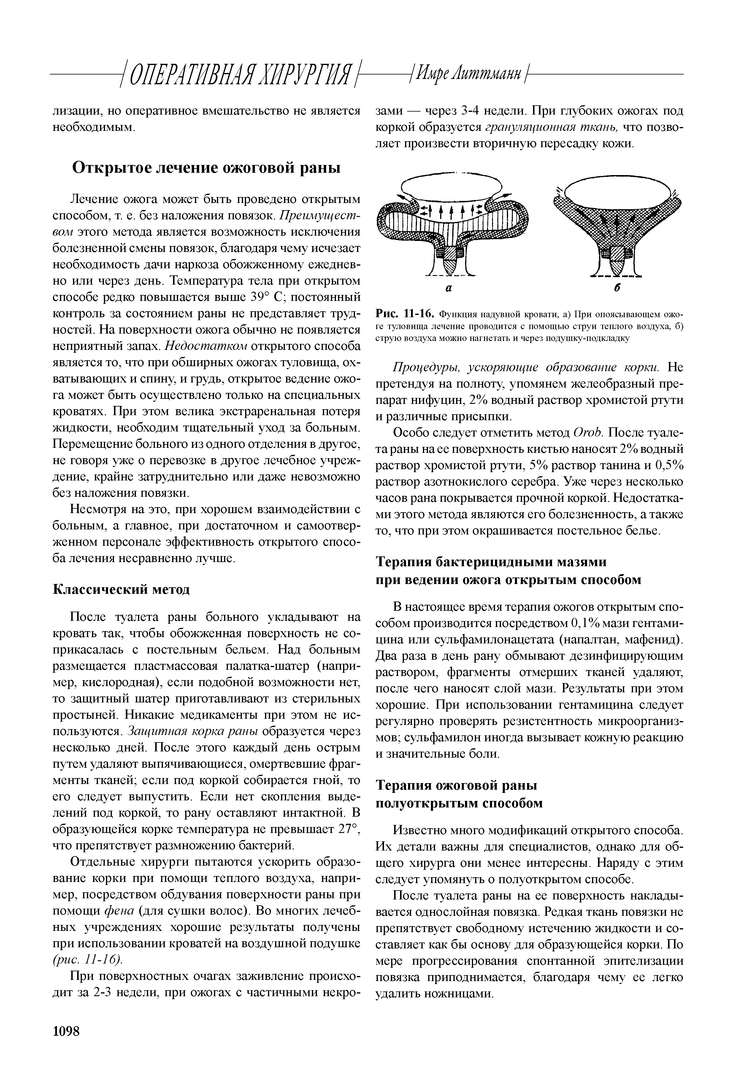 Рис. 11-16. Функция надувной кровати, а) При опоясывающем ожо-ге туловища лечение проводится с помощью струи теплого воздуха, б) струю воздуха можно нагнетать и через подушку-подкладку...