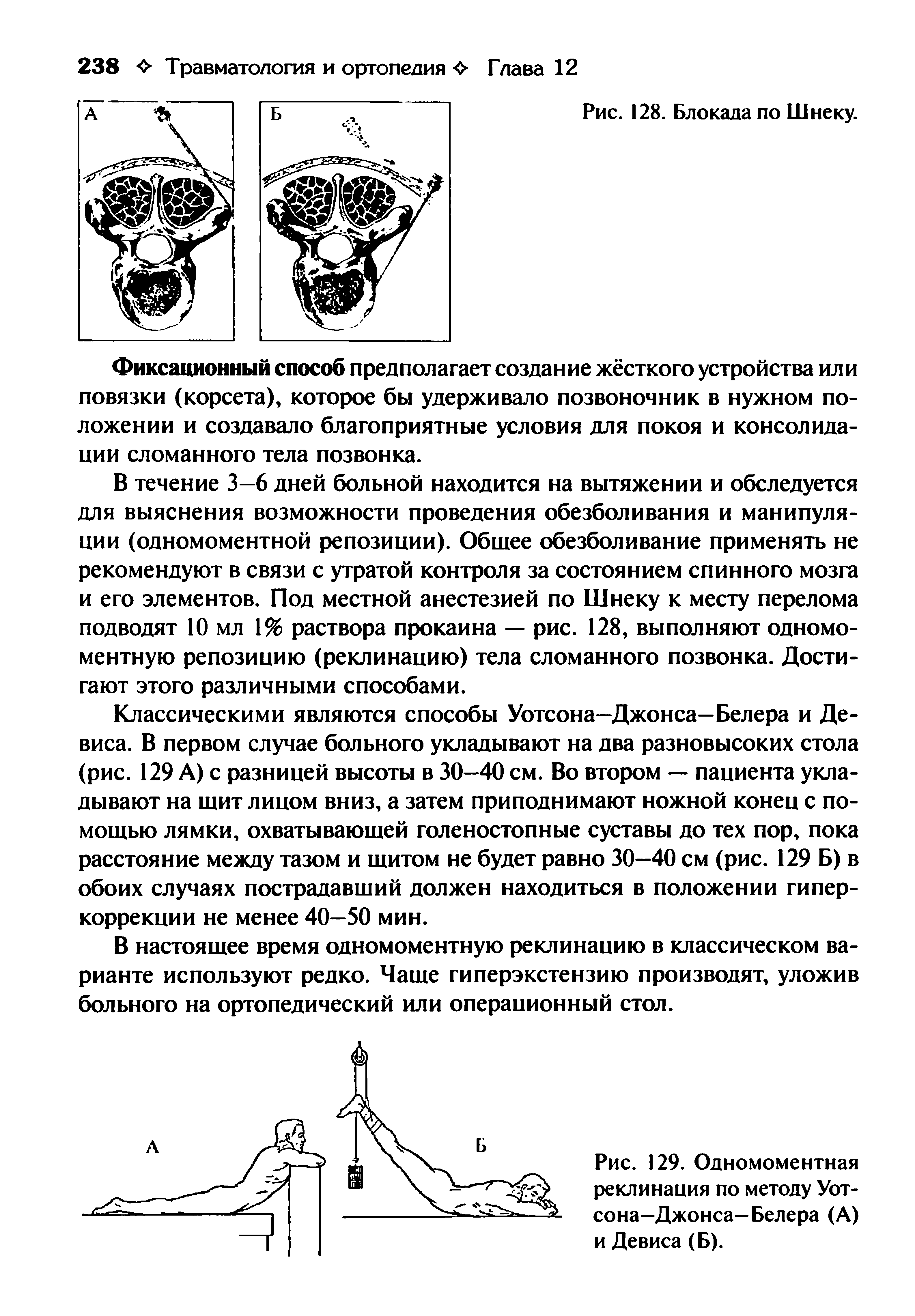 Рис. 129. Одномоментная реклинация по методу Уотсона-Джонса-Белера (А) и Девиса (Б).