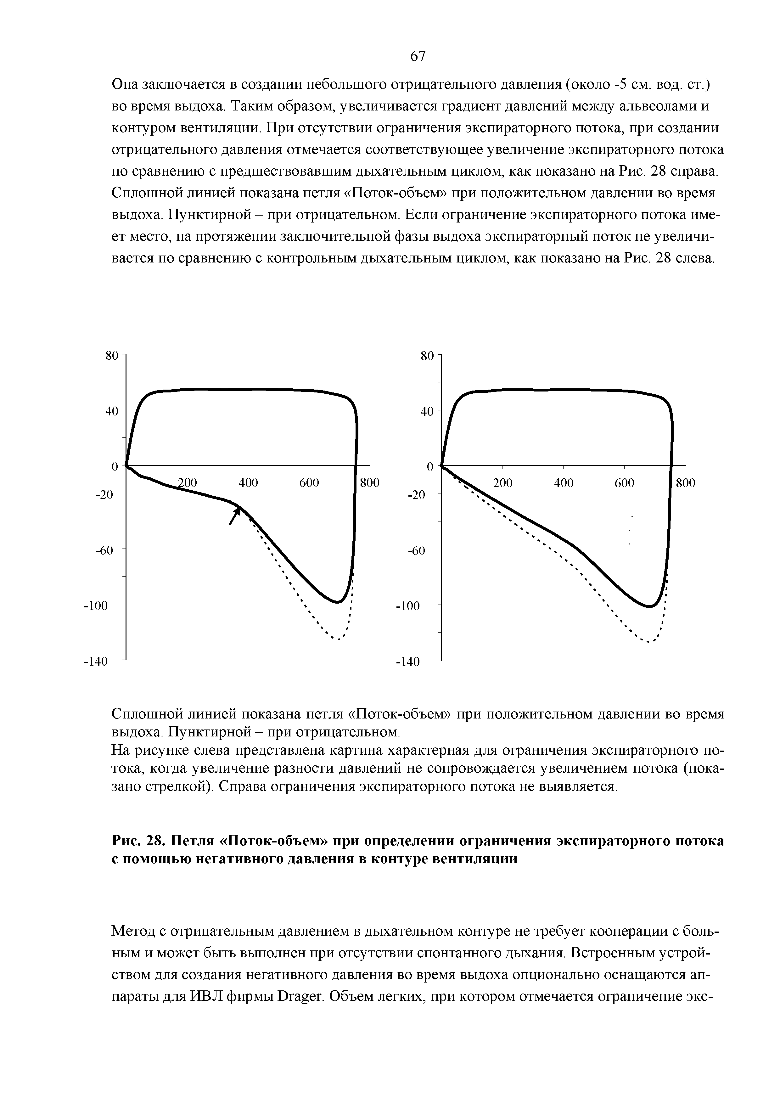 Рис. 28. Петля Поток-объем при определении ограничения экспираторного потока с помощью негативного давления в контуре вентиляции...