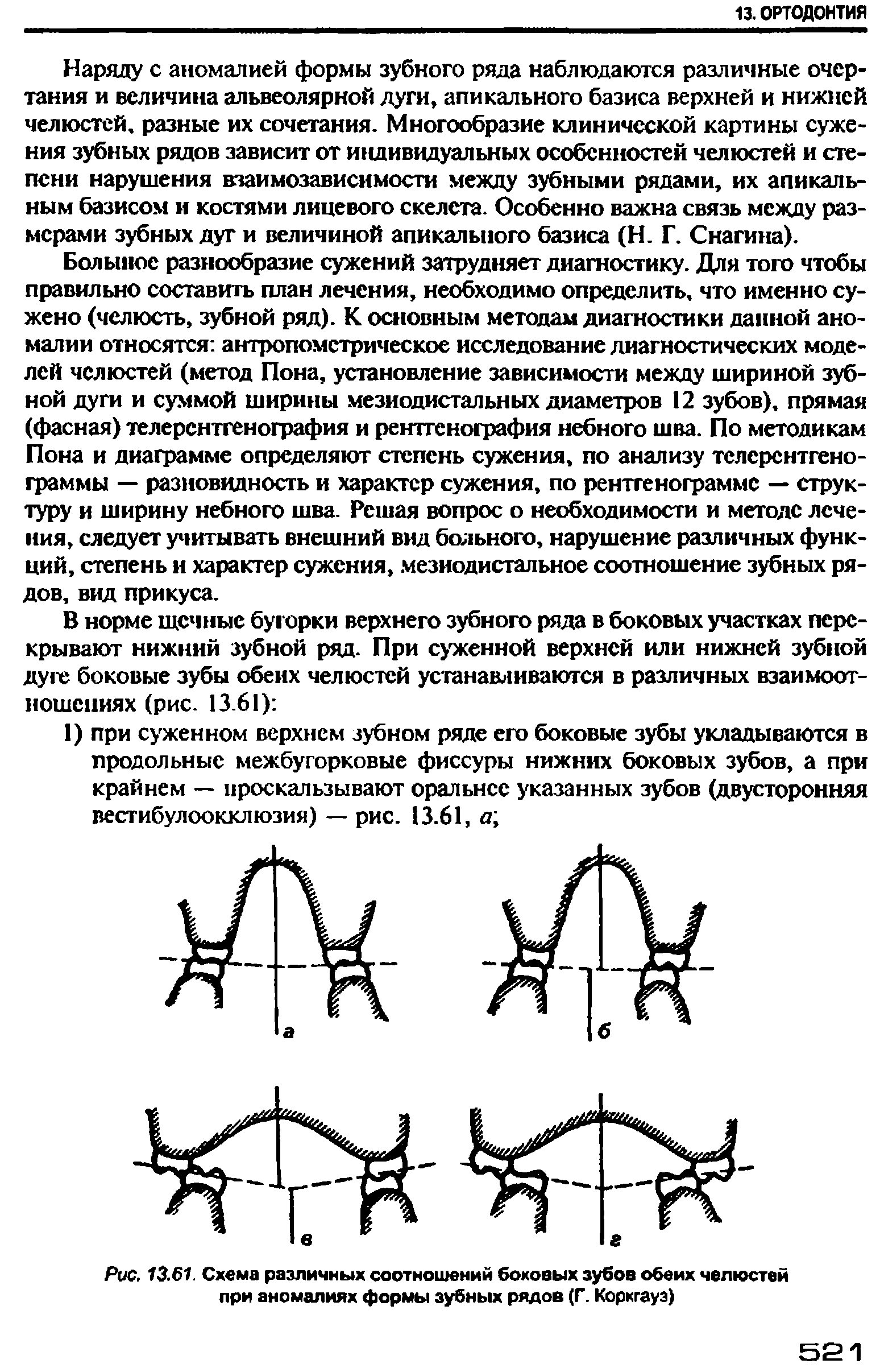 Рис. 13.61. Схема различных соотношений боковых зубов обеих челюстей при аномалиях формы зубных рядов (Г. Коркгауэ)...