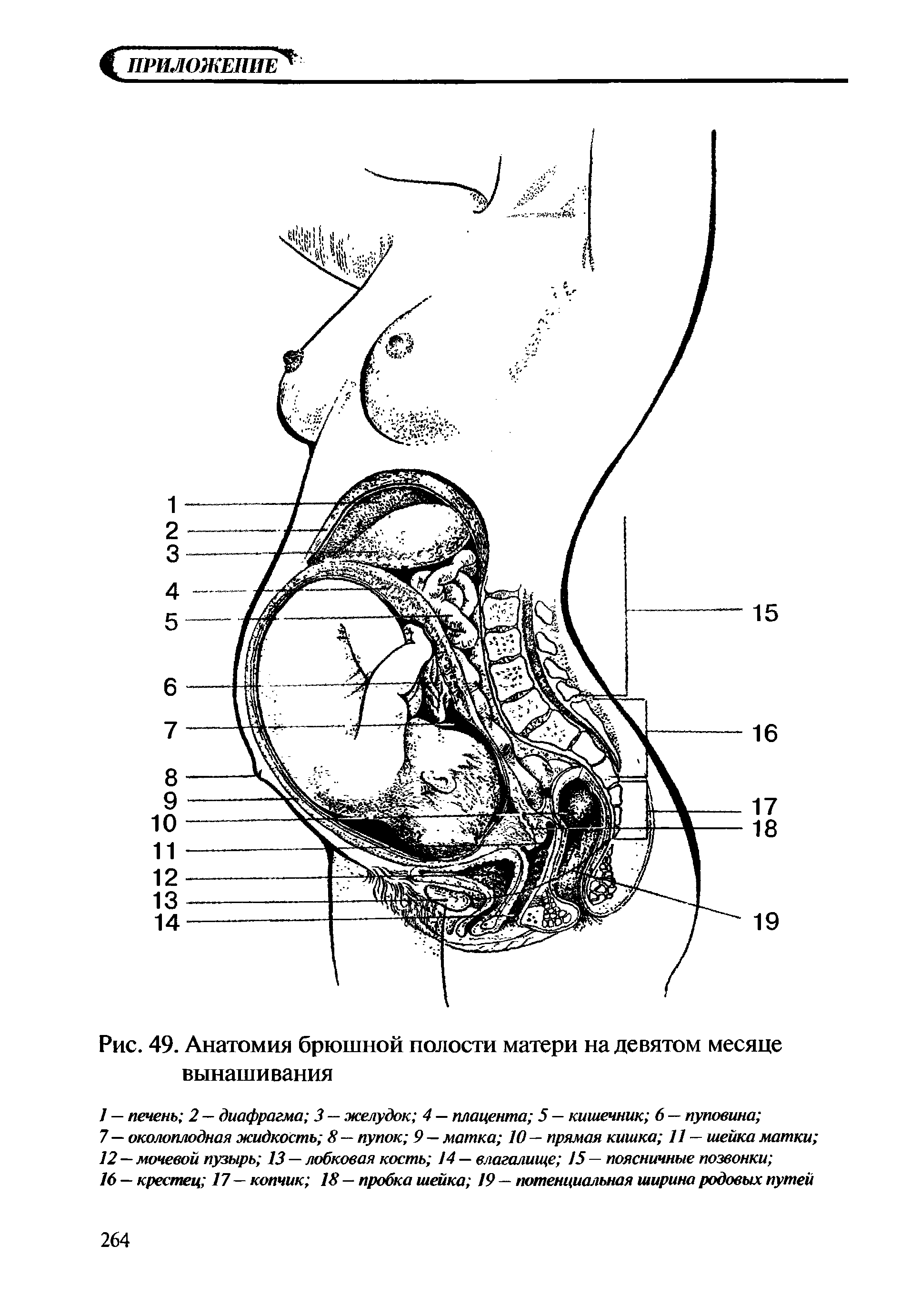 Рис. 49. Анатомия брюшной полости матери на девятом месяце вынашивания...