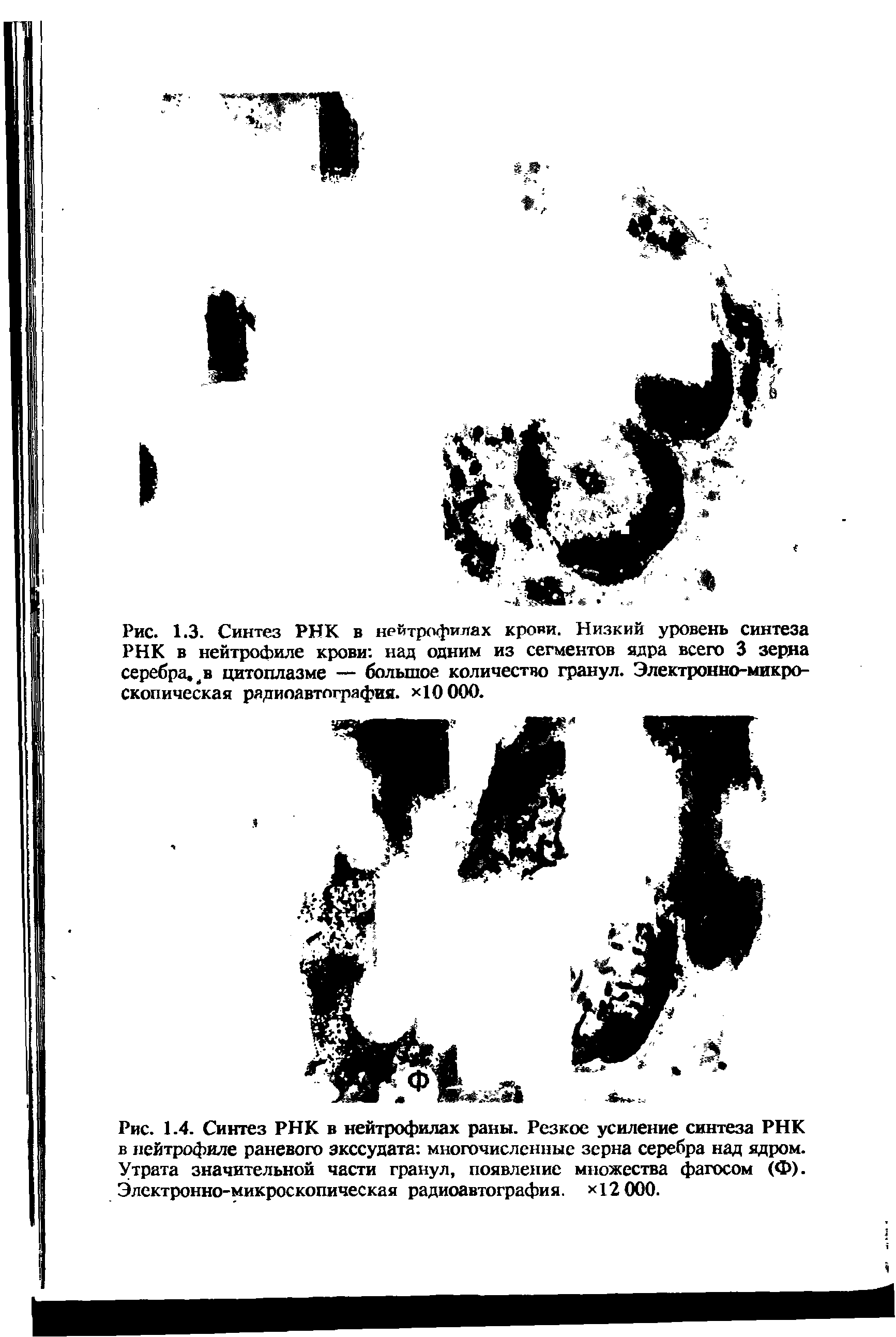 Рис. 1.4. Синтез РНК в нейтрофилах раны. Резкое усиление синтеза РНК в нейтрофиле раневого экссудата многочисленные зерна серебра над ядром. Утрата значительной части гранул, появление множества фагосом (Ф). Электронно-микроскопическая радиоавтография. Х12 000.