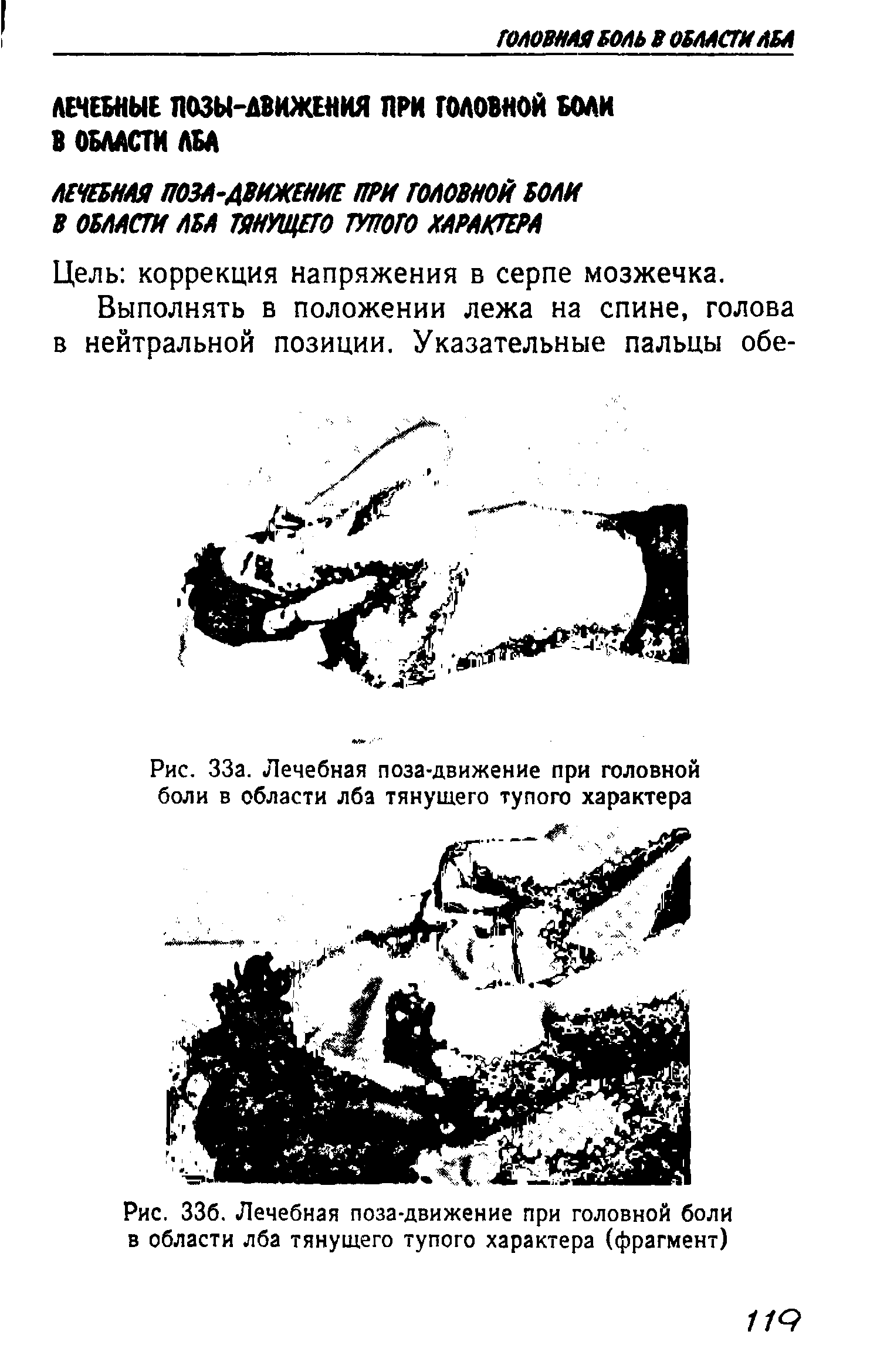 Рис. 33а. Лечебная поза-движение при головной боли в области лба тянущего тупого характера...