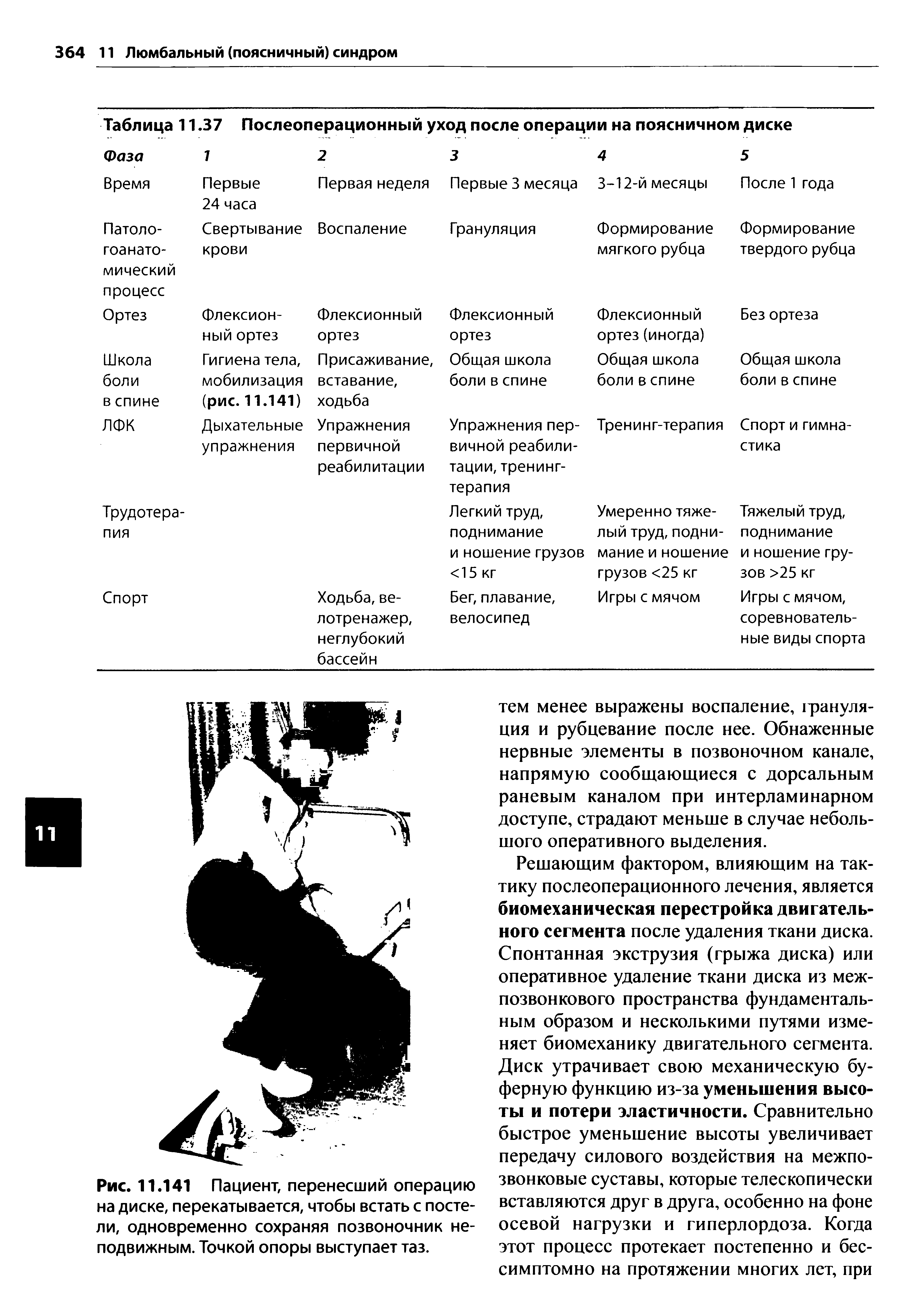 Таблица 11.37 Послеоперационный уход после операции на поясничном диске...