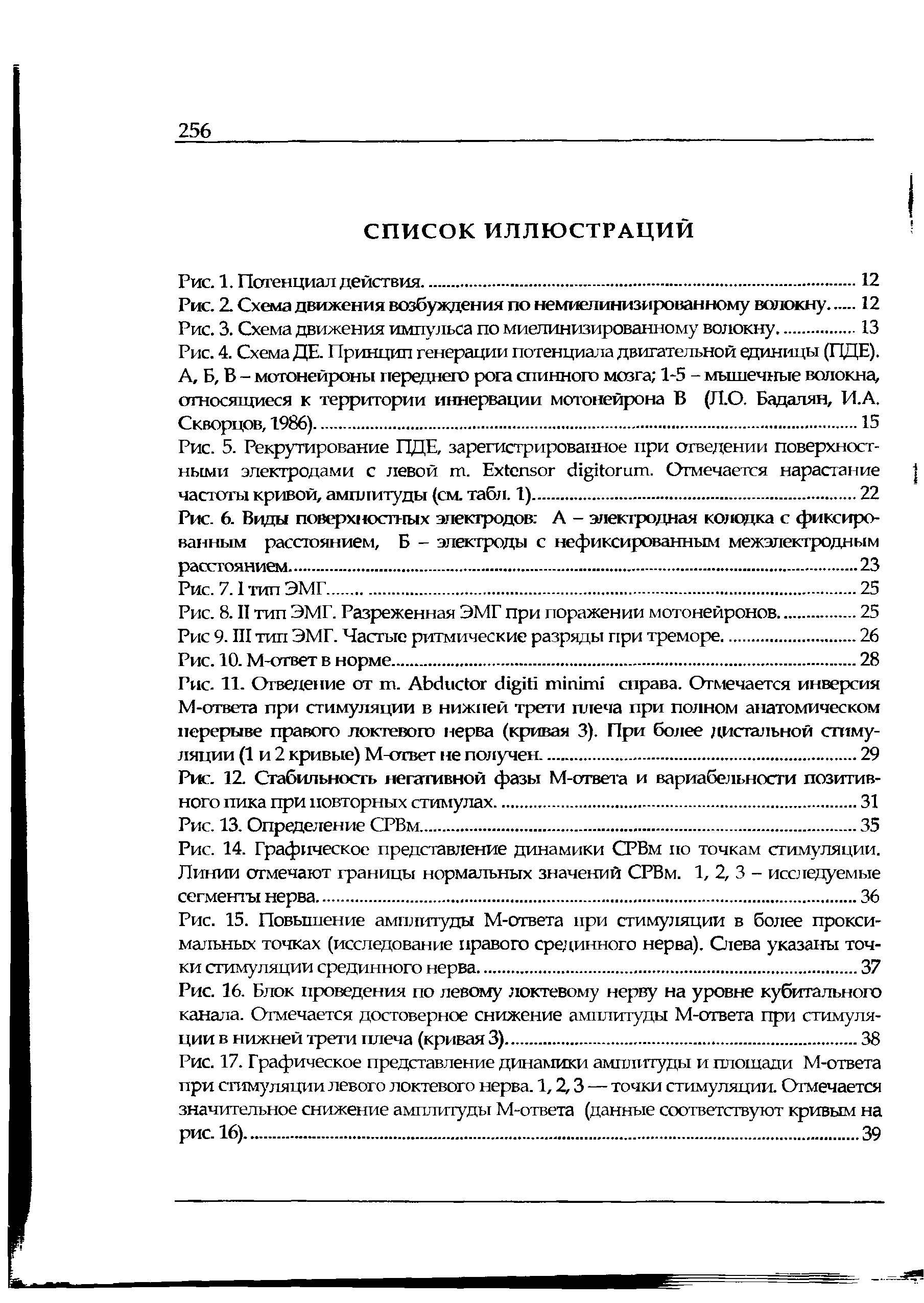 Рис. 4. Схема ДЕ. Принцип генерации потенциала двигательной единицы (ПДЕ). А, Б, В - мотонейроны переднего рога спинного мозга 1-5 - мышечные волокна, относящиеся к территории иннервации мотонейрона В (Л.О. Бадалян, И.А. Скворцов, 1986).15...