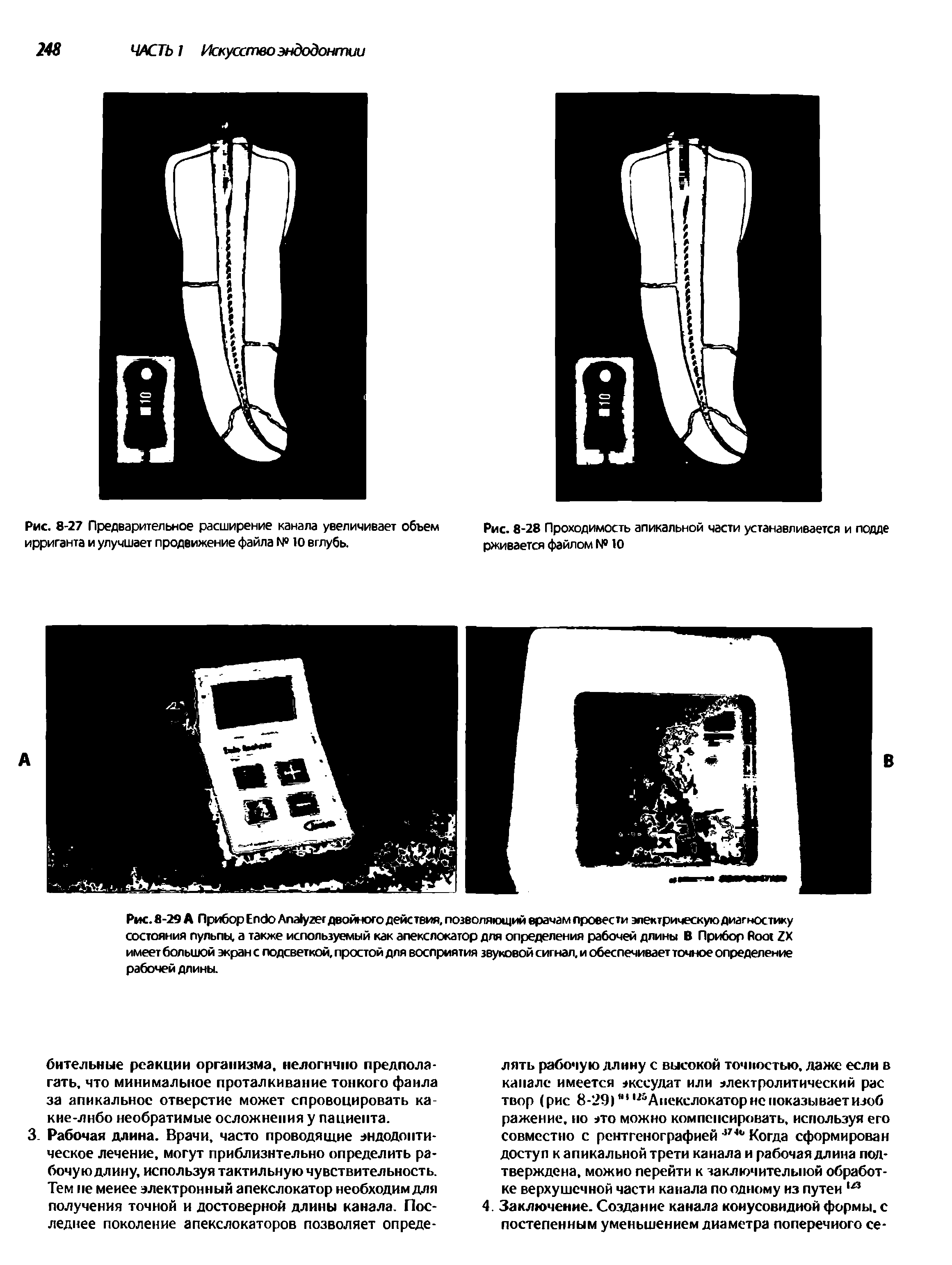 Рис.8-29 А Прибор E A двойного действия, позволяющий врачам провести электрическую диагностику состояния пульпы, а также используемый как апекслокатор для определения рабочей длины В Прибор R ZX имеет большой экран с подсветкой, простой для восприятия звуковой сигнал, и обеспечивает точное определение рабочей длины.