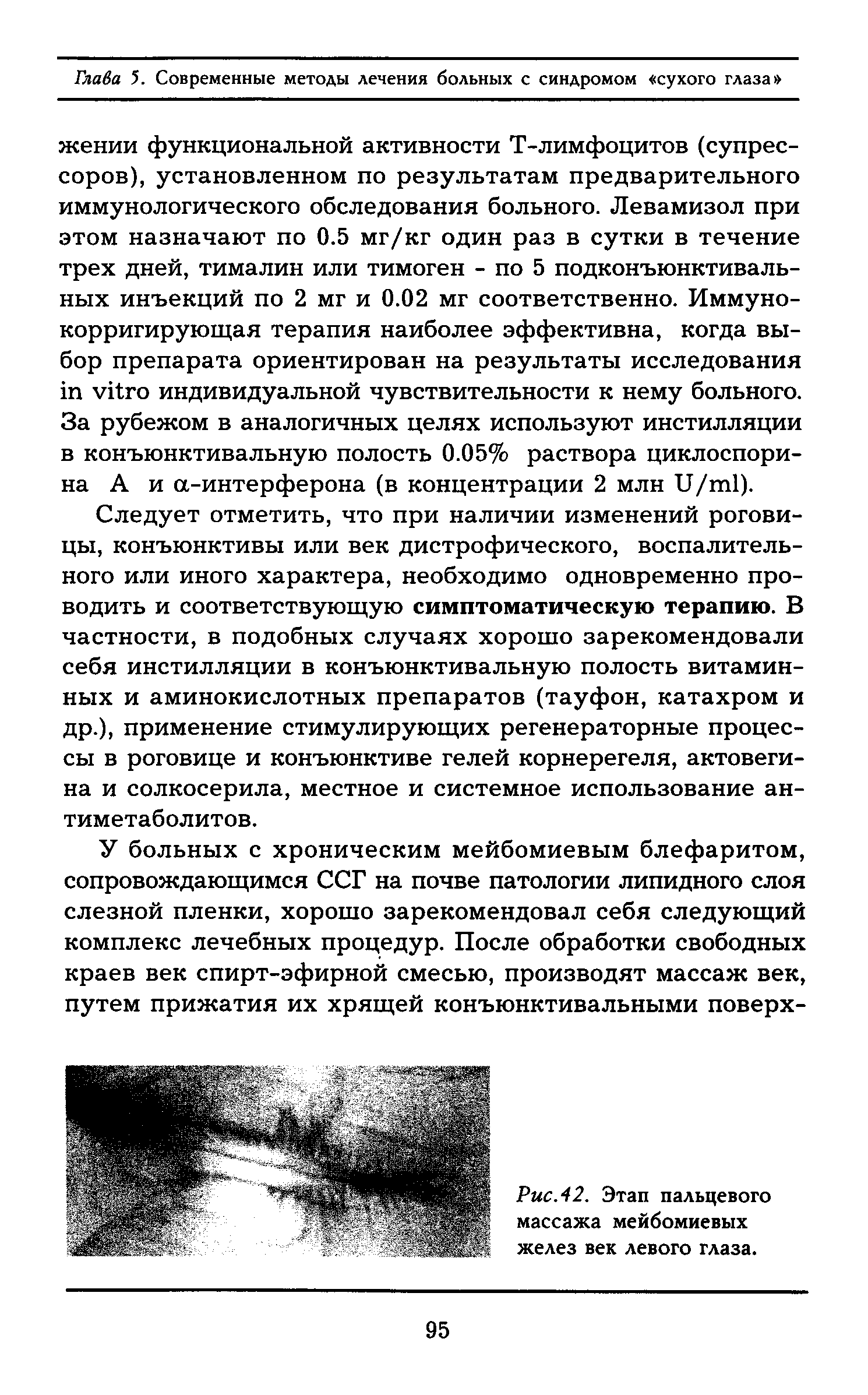 Рис.42. Этап пальцевого массажа мейбомиевых желез век левого глаза.