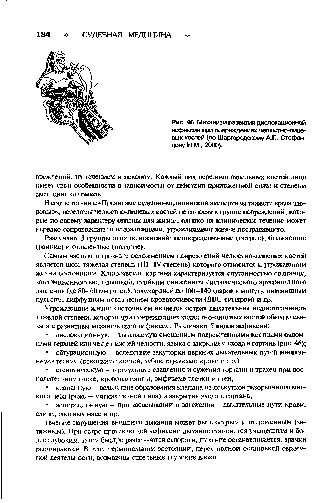 Рис. 46. Механизм развития дислокационной асфиксии при повреждениях челюстно-лицевых костей (по Шаргородскому А.Г.. Стефан-цову Н.М., 2000).