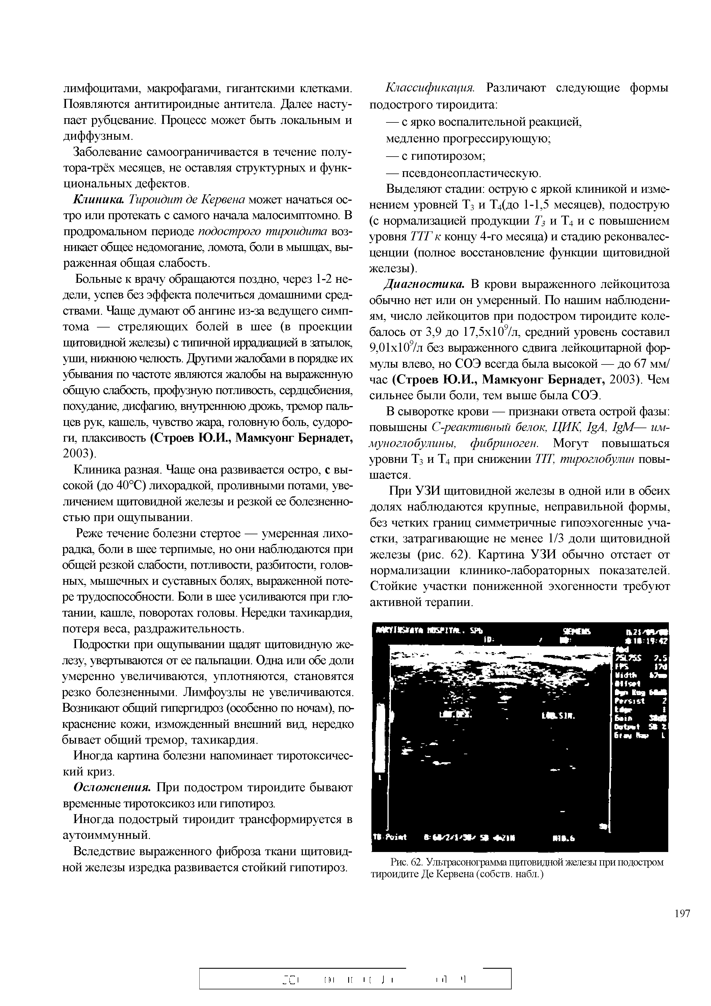Рис. 62. Ультрасонограмма щитовидной железы при подостром тироидите Де Кервена (собств. набл.)...