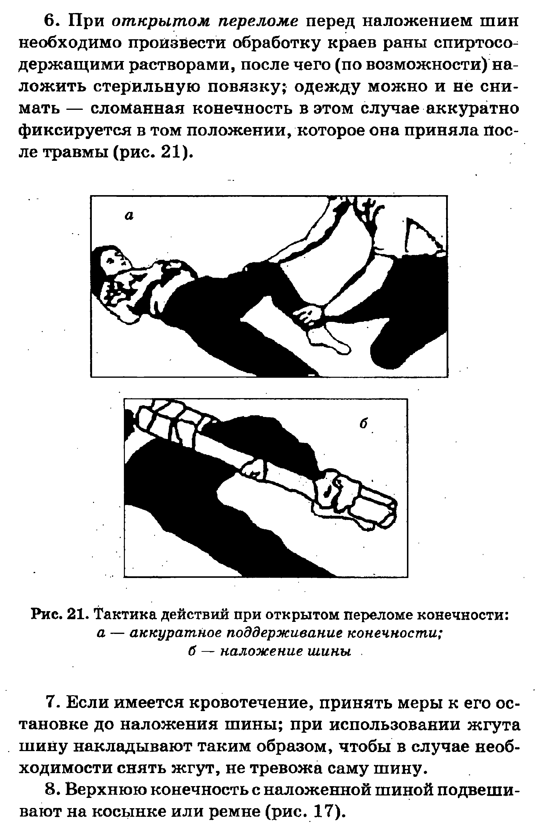 Рис. 21. Тактика действий при открытом переломе конечности а — аккуратное поддерживание конечности ...