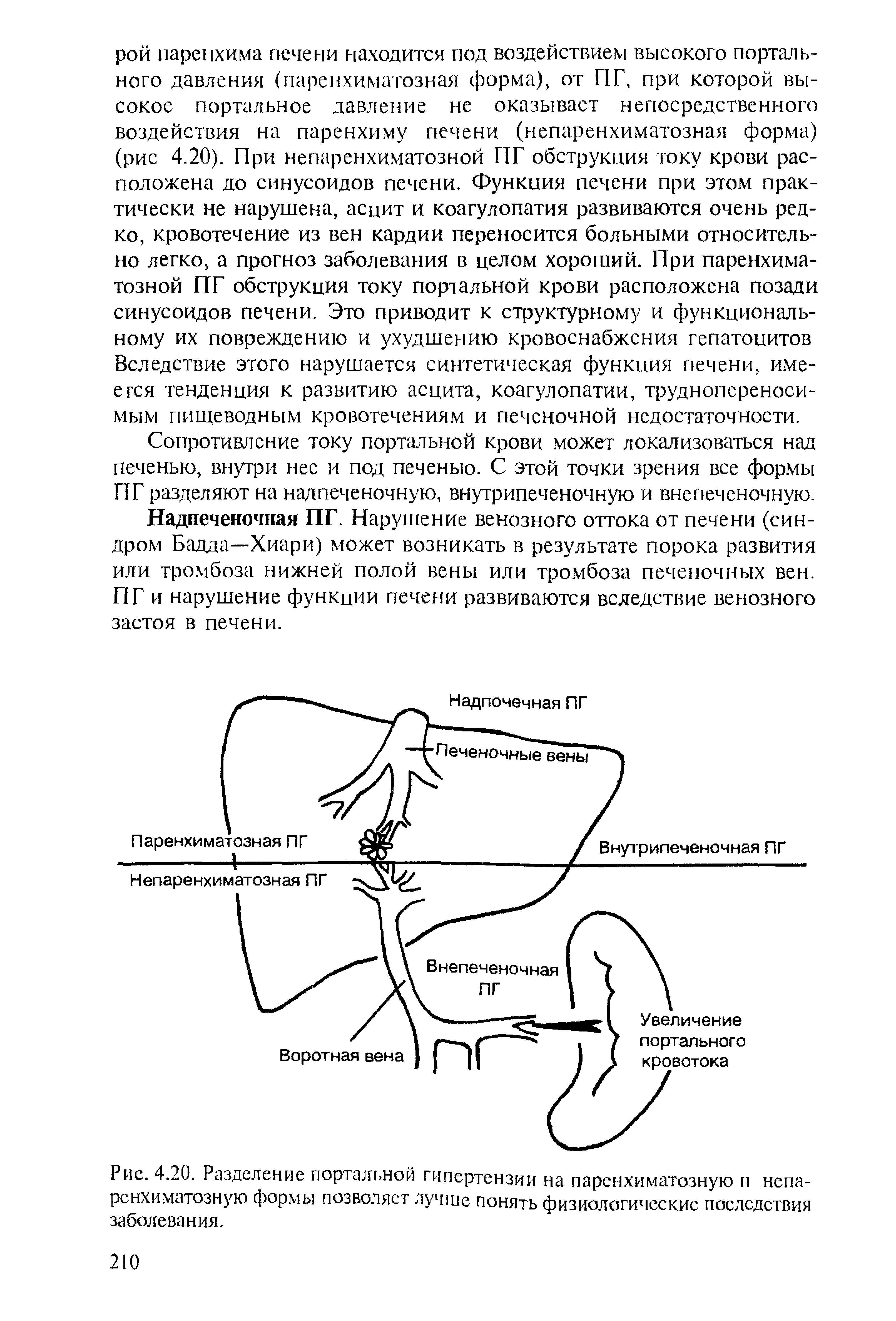 Рис. 4.20. Разделение портальной гипертензии на паренхиматозную и непаренхиматозную формы позволяет лучше понять физиологические последствия заболевания.