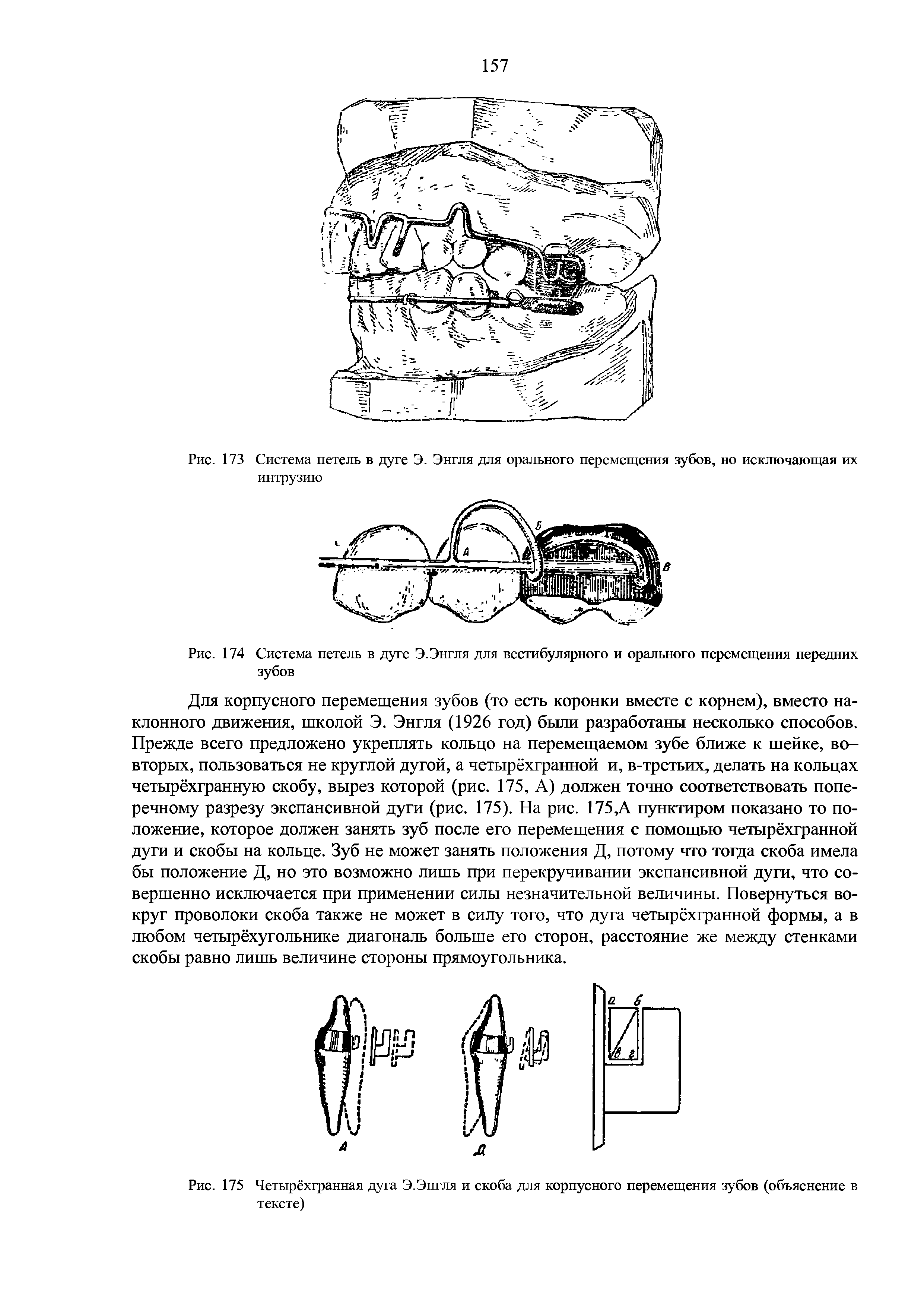 Рис. 175 Четырёхгранная дуга Э.Энгля и скоба для корпусного перемещения зубов (объяснение в тексте)...