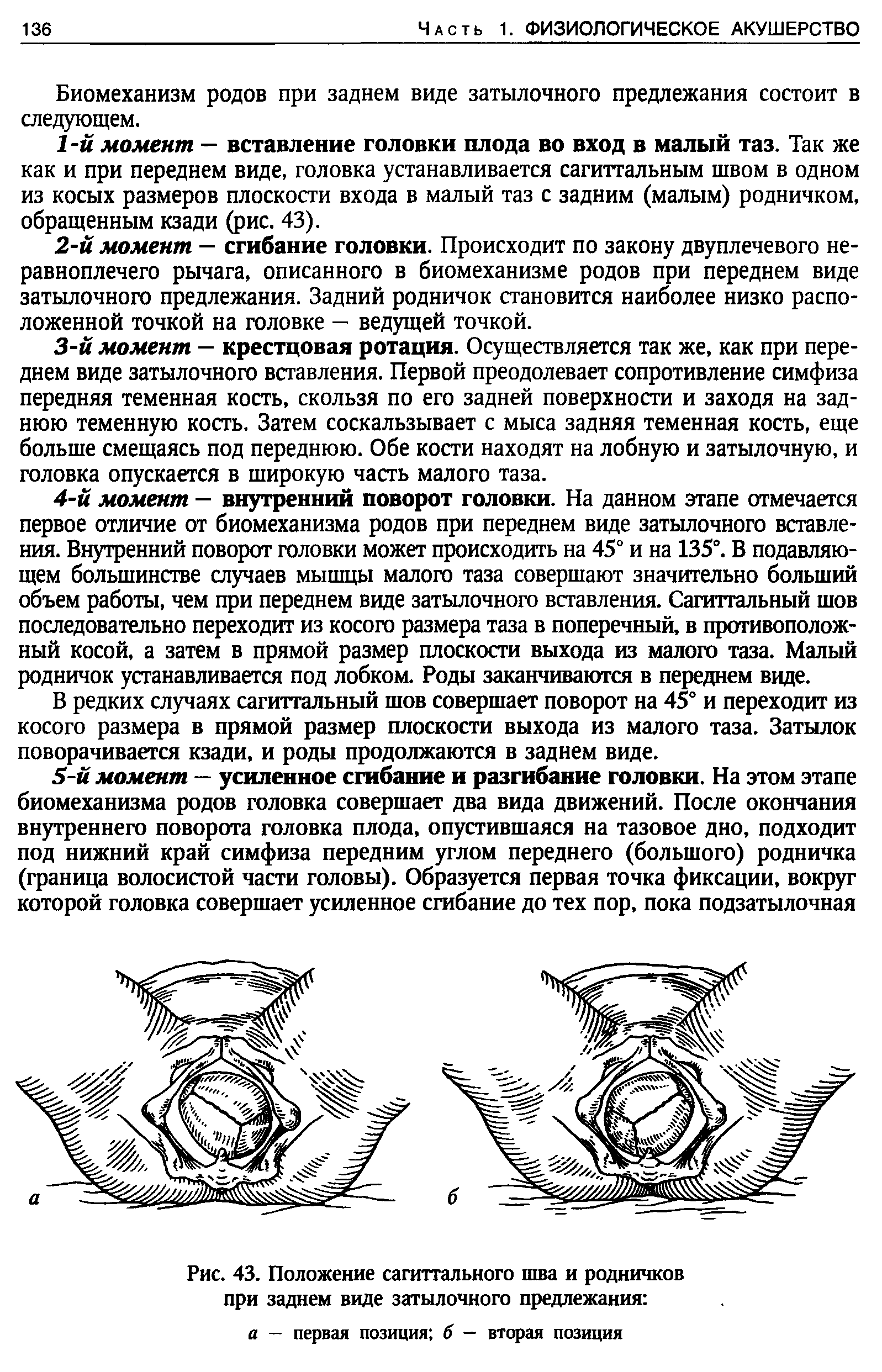 Рис. 43. Положение сагиттального шва и родничков при заднем виде затылочного предлежания а — первая позиция б — вторая позиция...