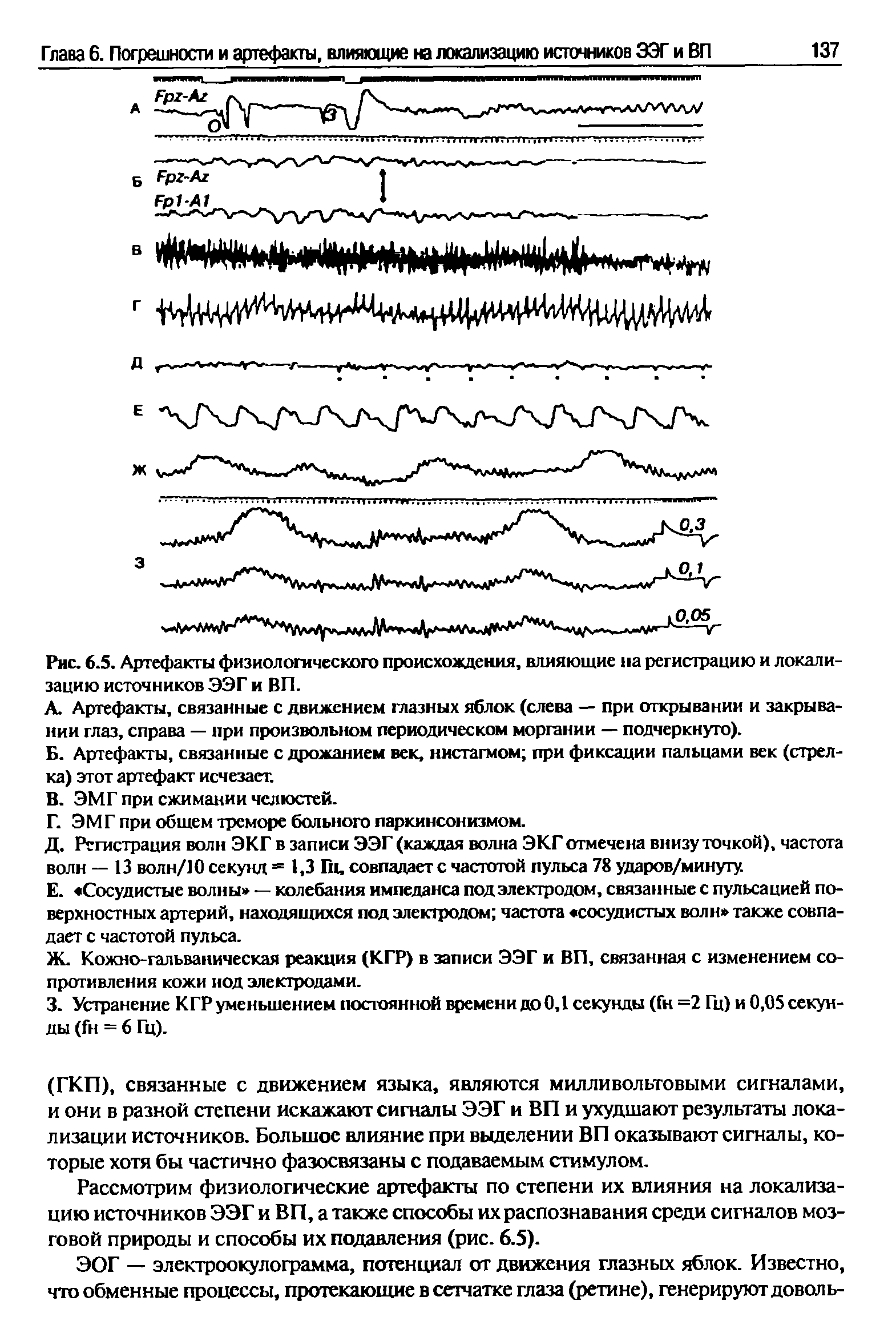 Рис. 6.5. Артефакты физиологического происхождения, влияющие на регистрацию и локализацию источников ЭЭГ и ВП.